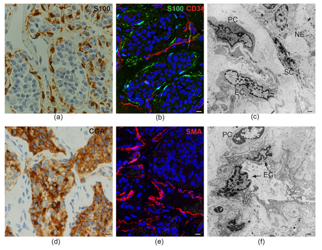 Cancers 11 00273 g001 Cancers 11 00273 g001