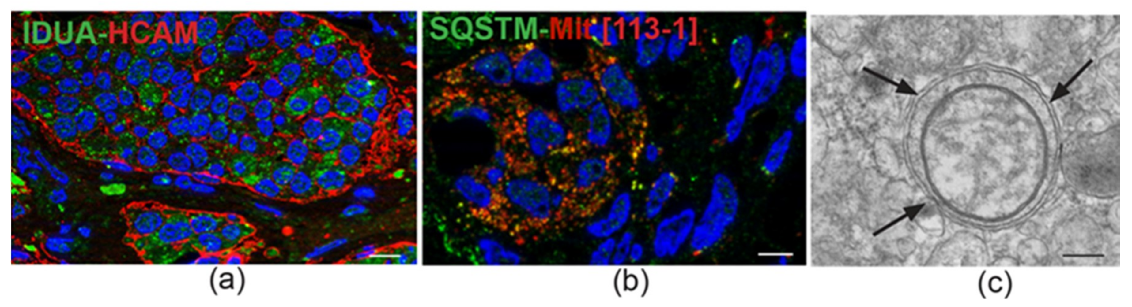 Cancers 11 00273 g002 Cancers 11 00273 g002