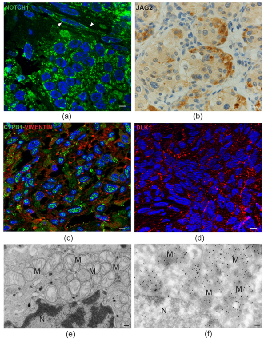 Cancers 11 00273 g003 Cancers 11 00273 g003