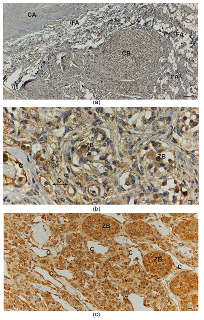 Cancers 11 00273 g004 Cancers 11 00273 g004