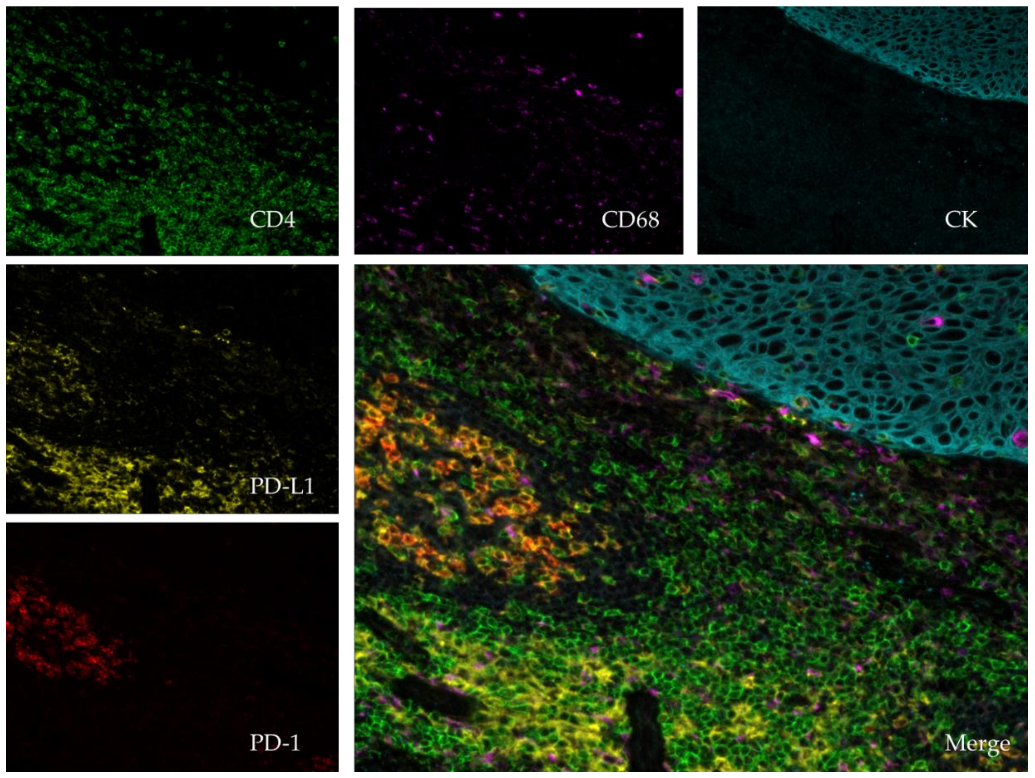 Cancers 11 00283 g002