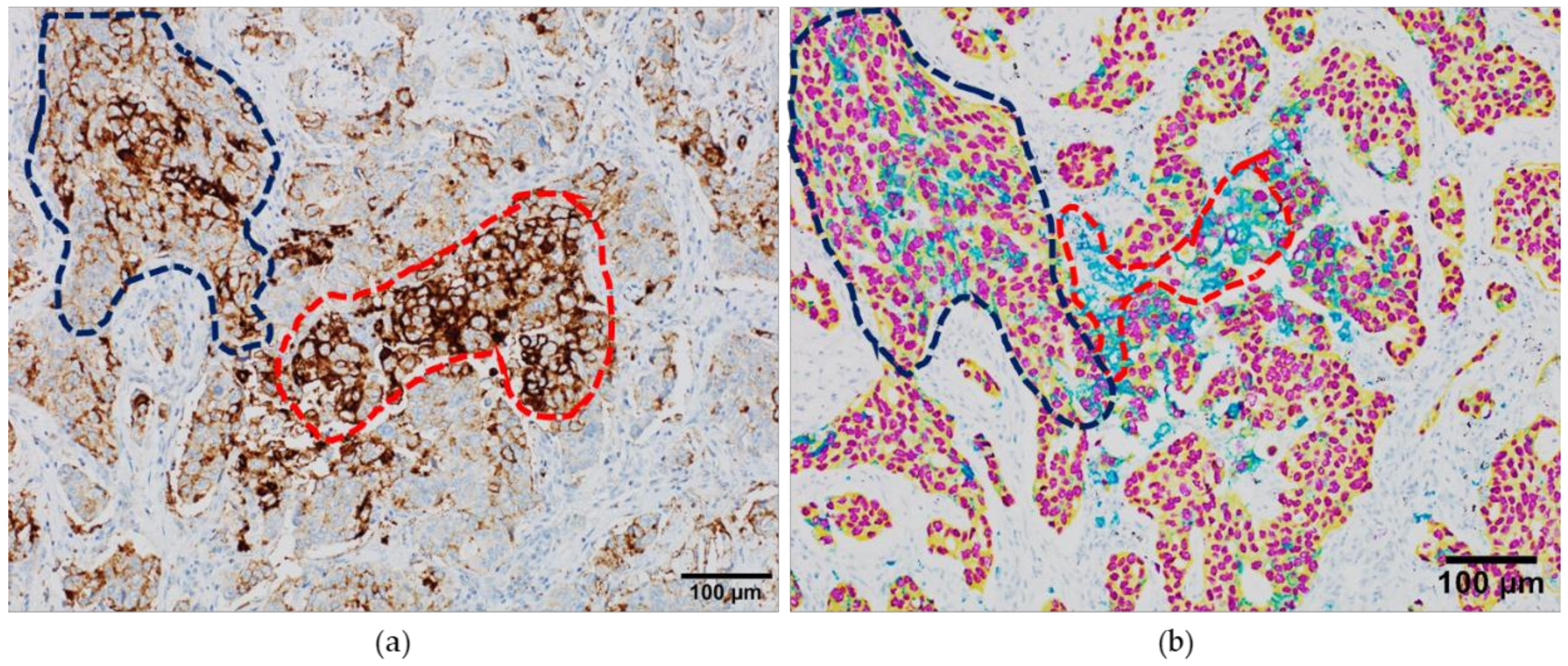 Cancers 11 00283 g003