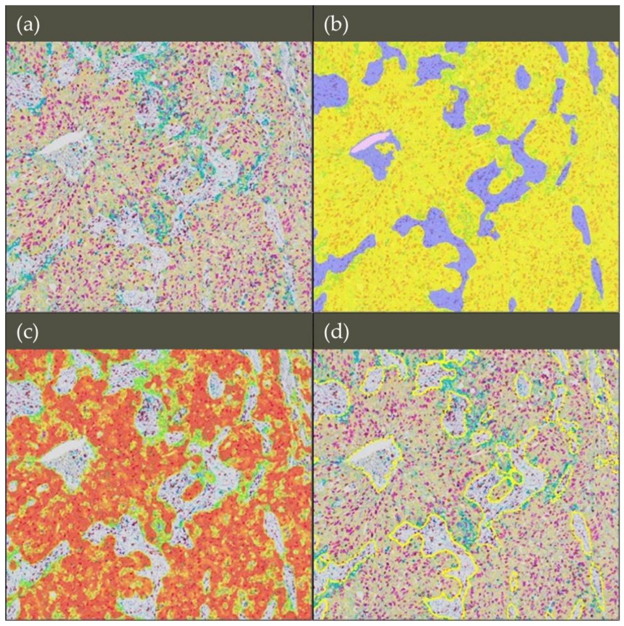 Cancers 11 00283 g005