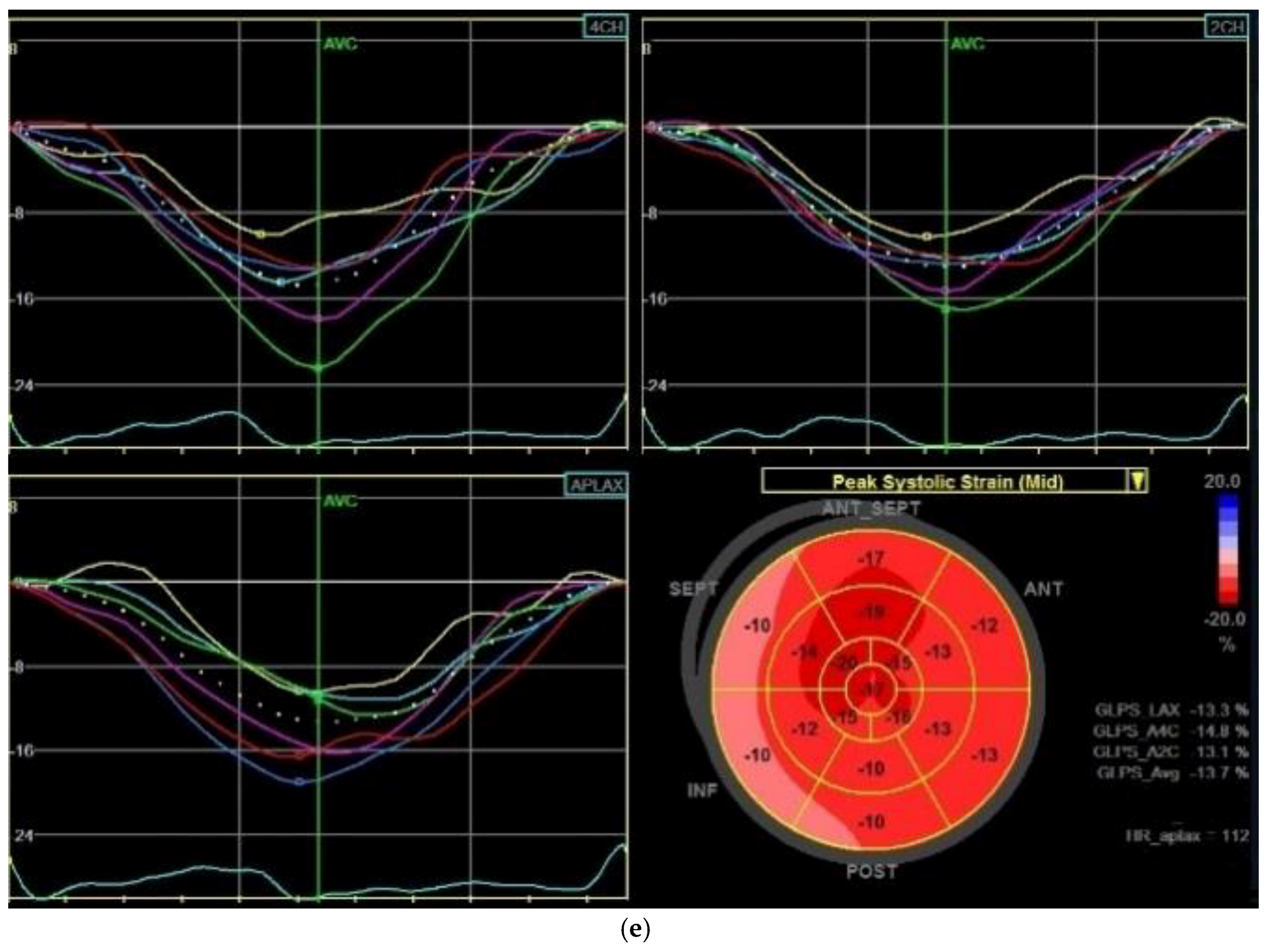 Cancers 11 00318 g002b