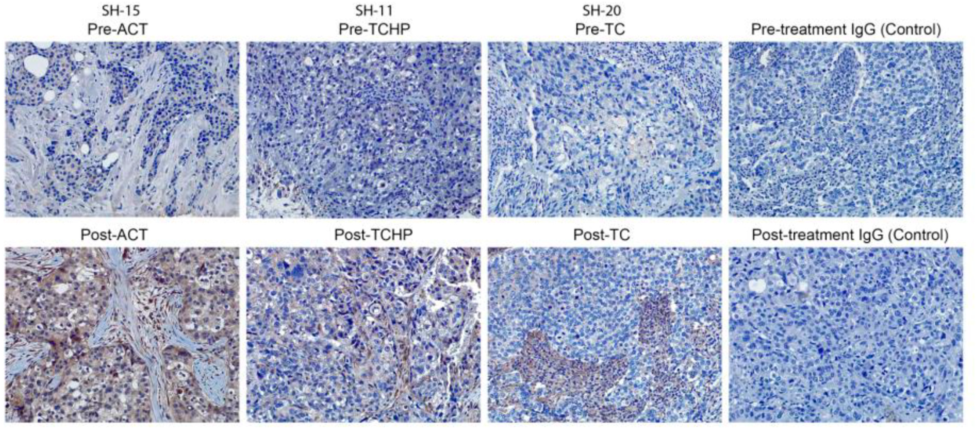 Cancers 11 00340 g004