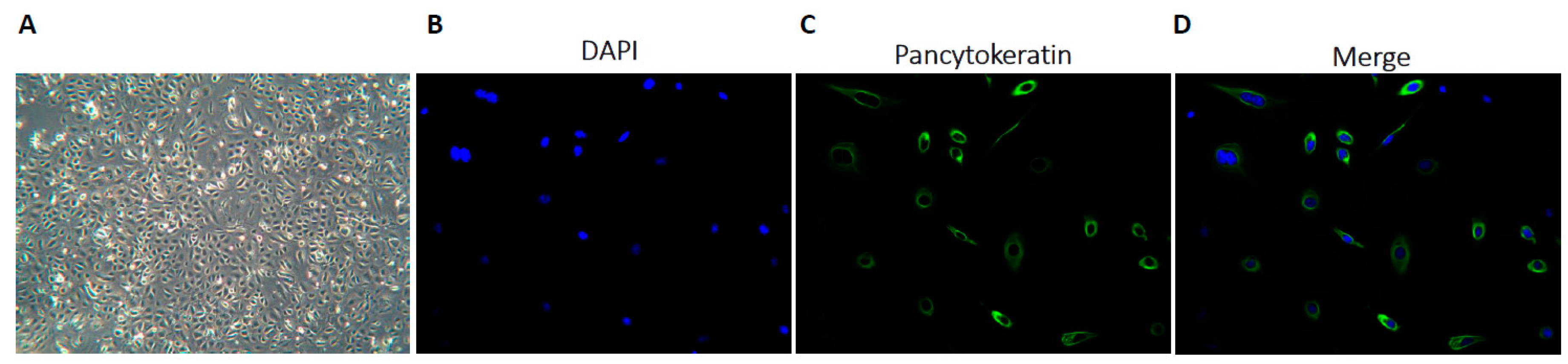 Cancers 11 00354 g001 Cancers 11 00354 g001