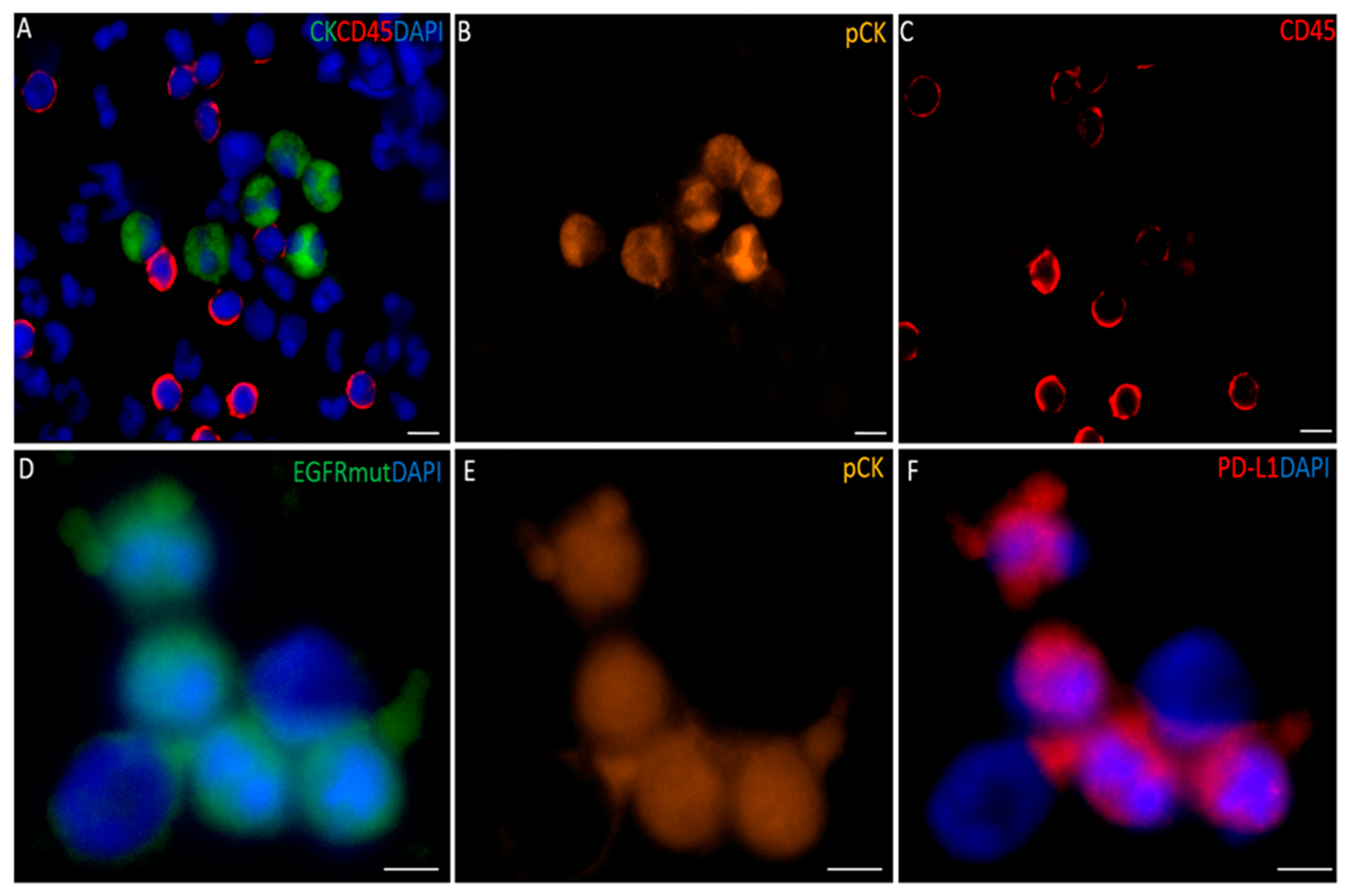 Cancers 11 00380 g001