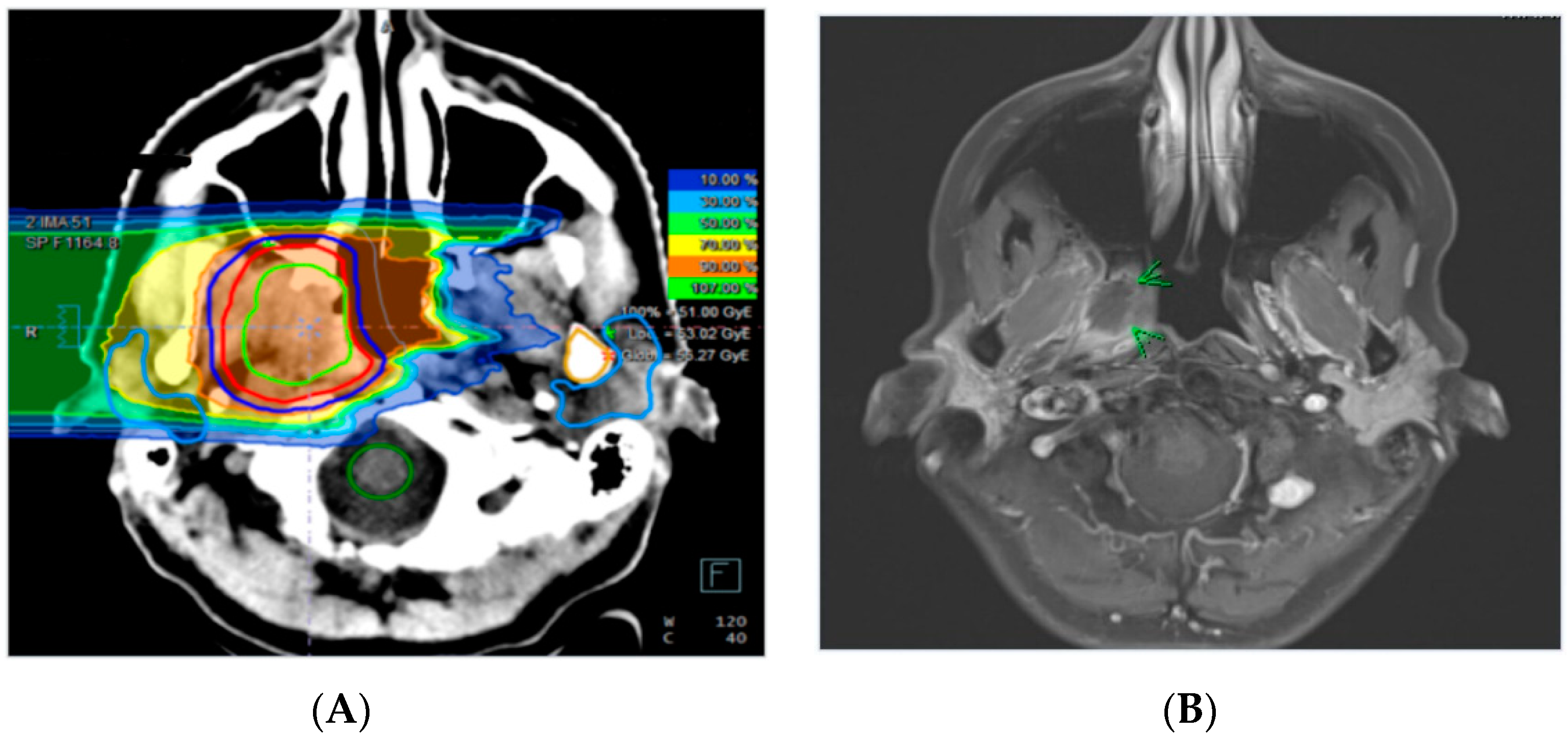 Cancers 11 00383 g002 Cancers 11 00383 g002