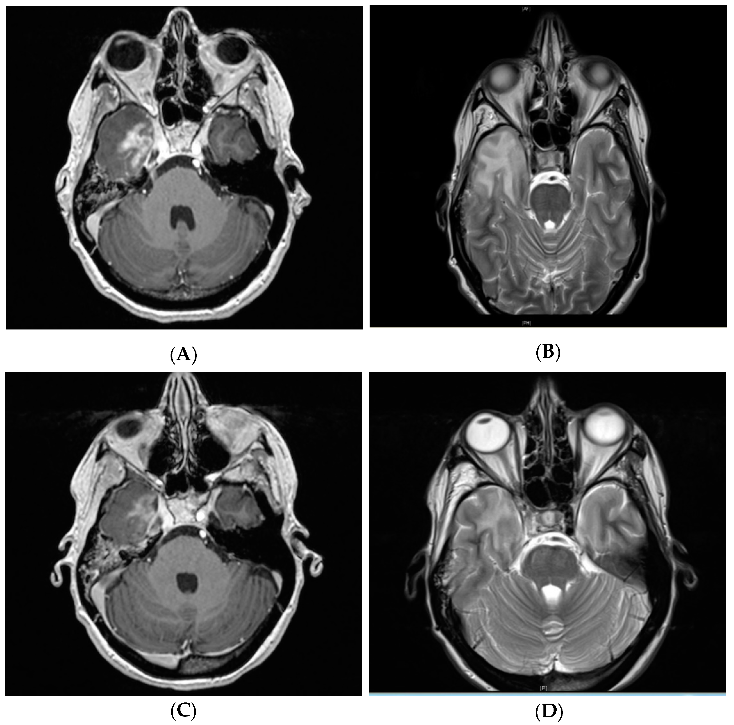 Cancers 11 00383 g003 Cancers 11 00383 g003