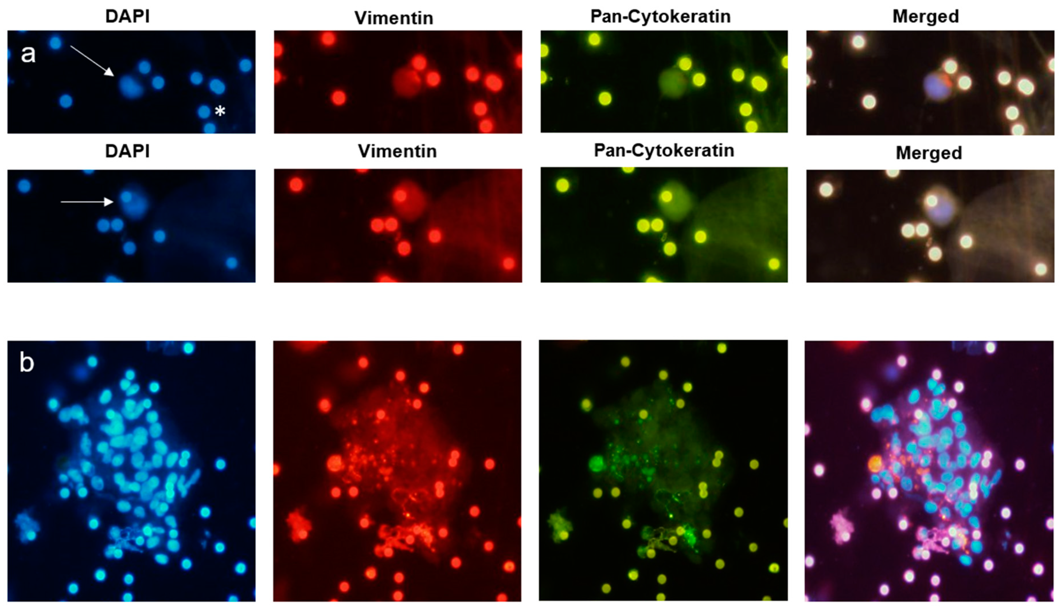 Cancers 11 00397 g004