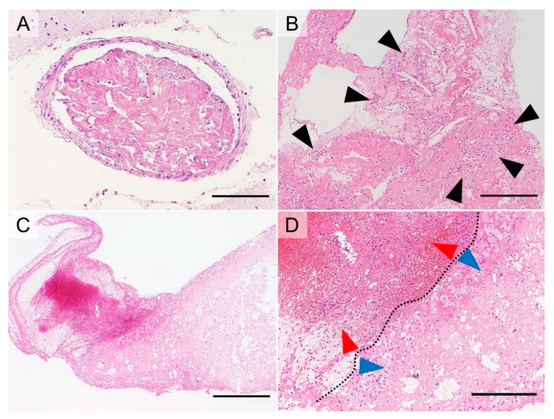 Cancers 11 00488 g004