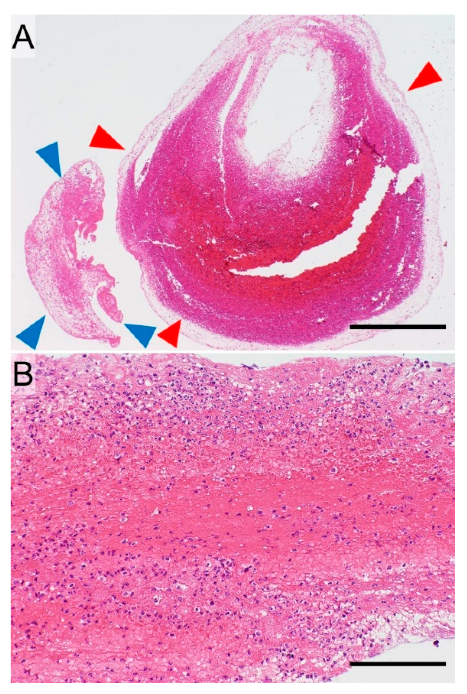 Cancers 11 00488 g006