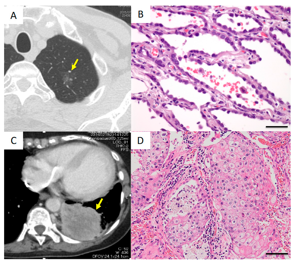 Cancers 11 00552 g004 Cancers 11 00552 g004