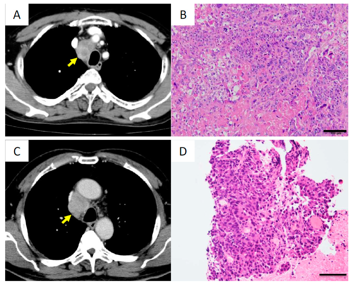 Cancers 11 00552 g007 Cancers 11 00552 g007