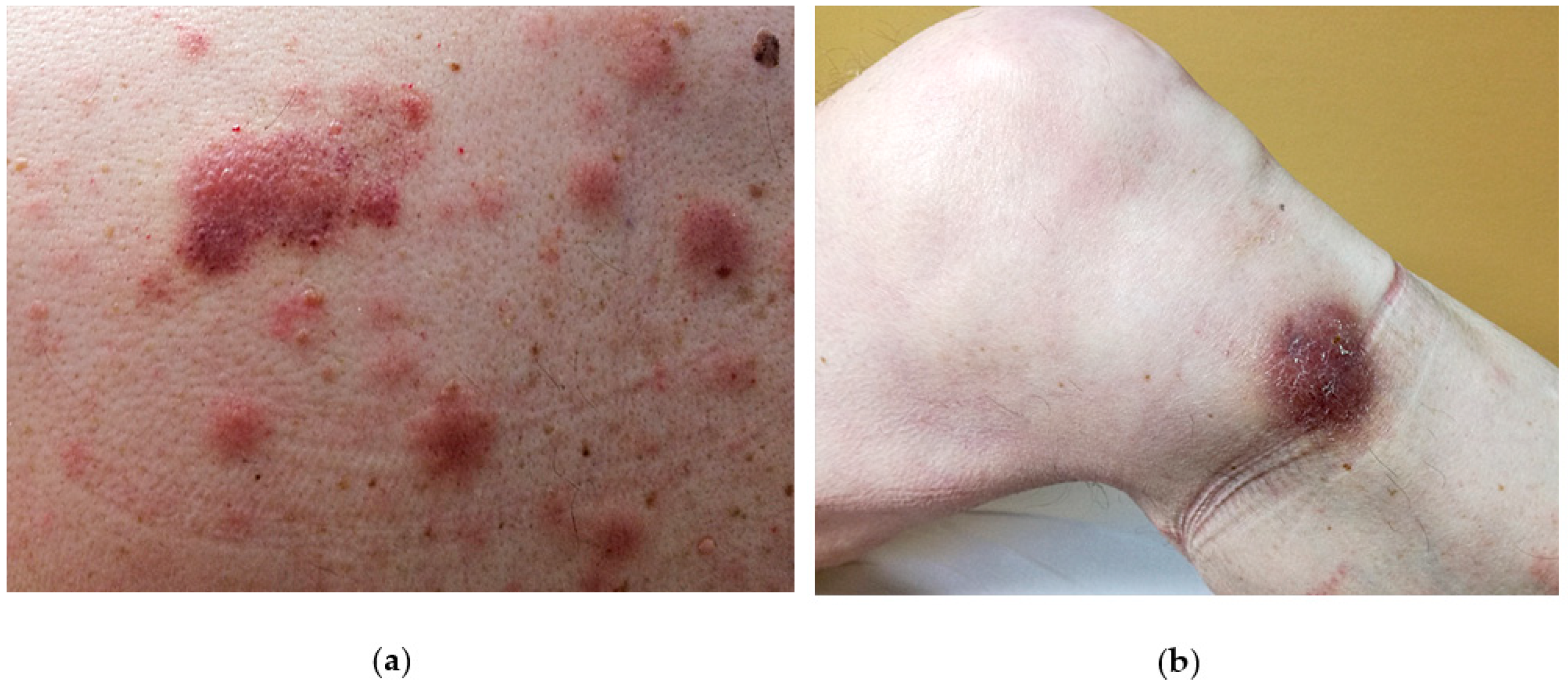 Cancers 11 00595 g001