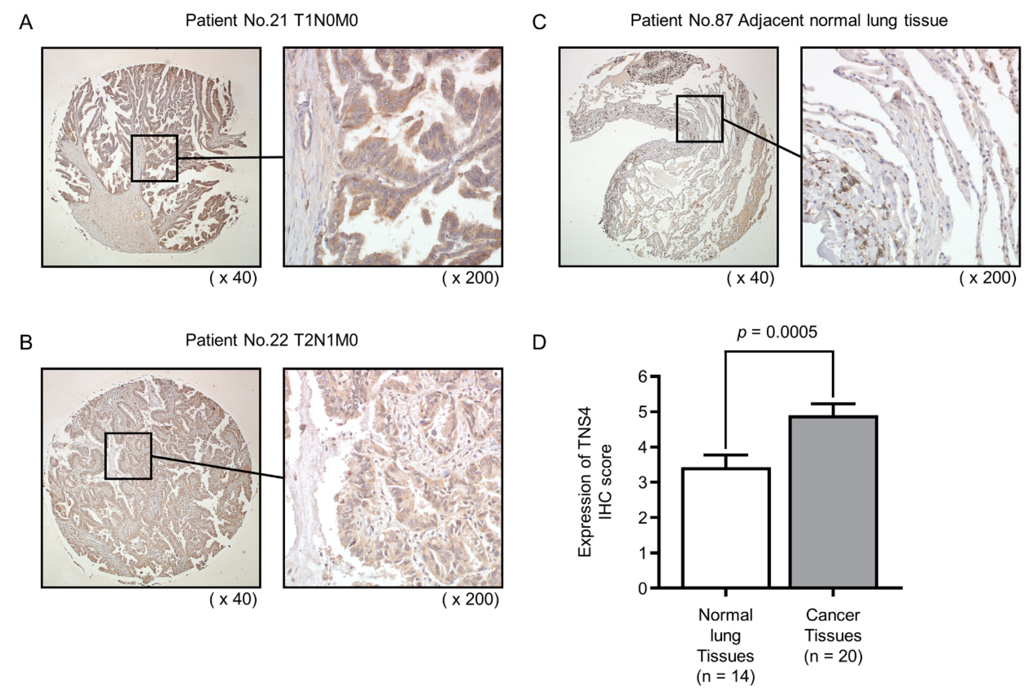 Cancers 11 00601 g005