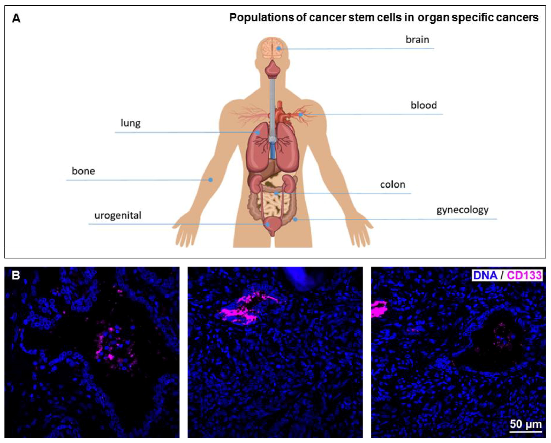 Cancers 11 00655 g003 Cancers 11 00655 g003