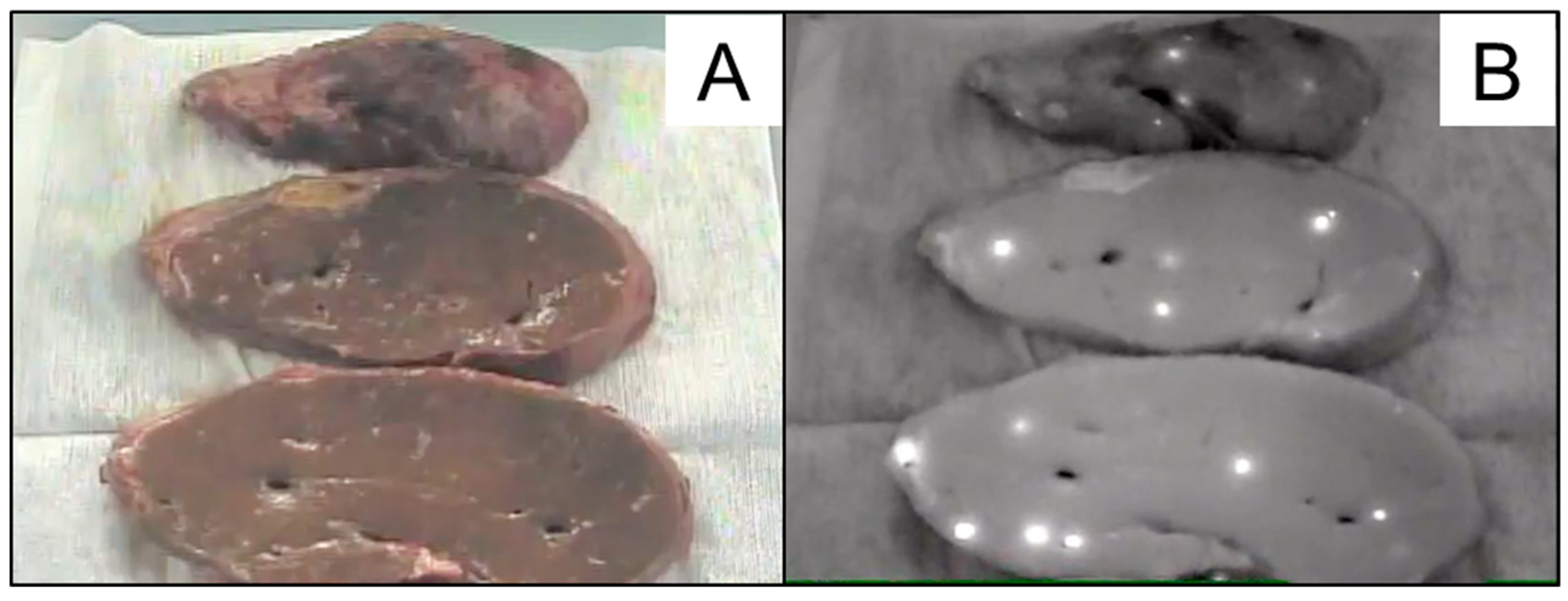 Cancers 11 00730 g004