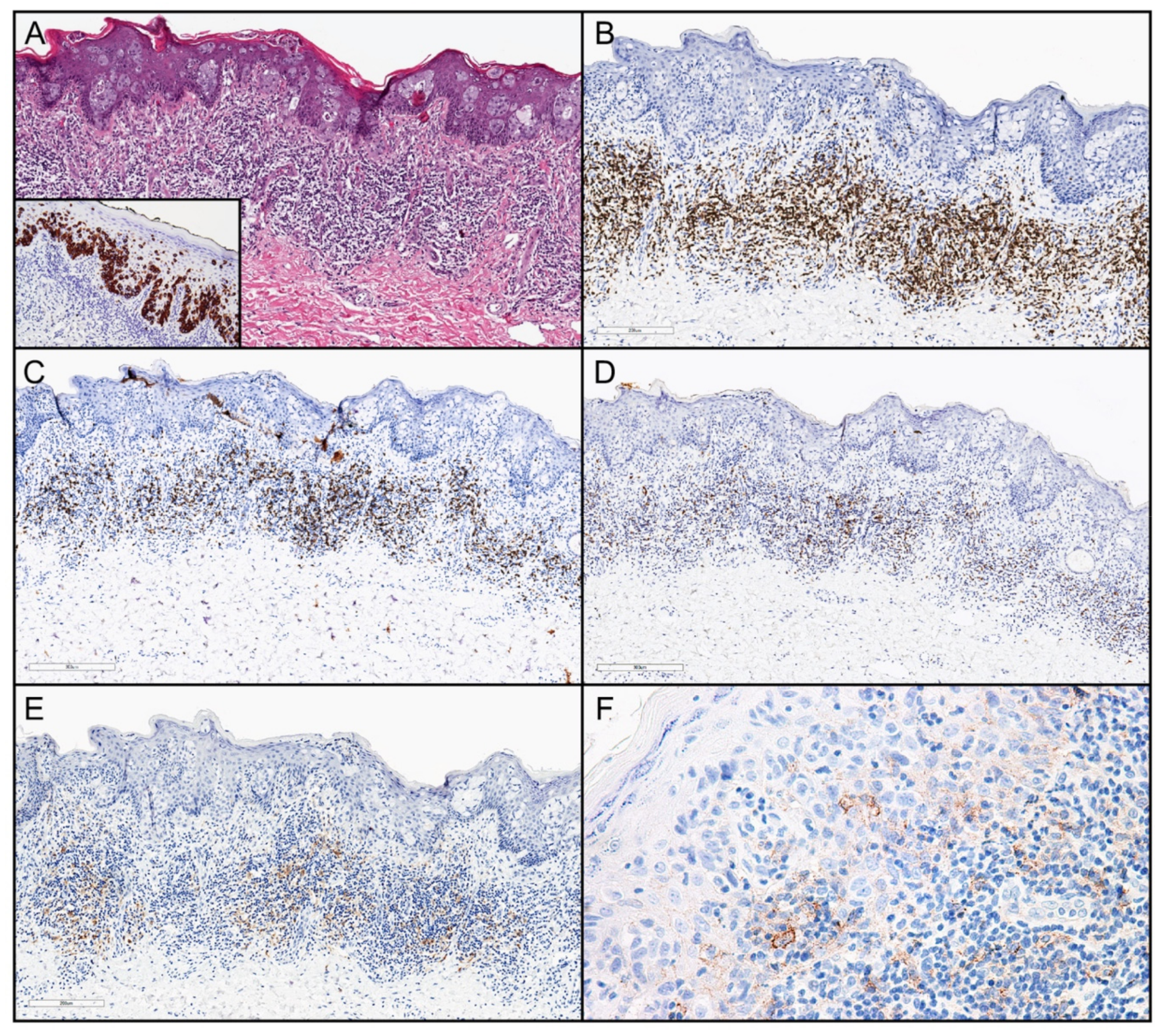 Cancers 11 00754 g001