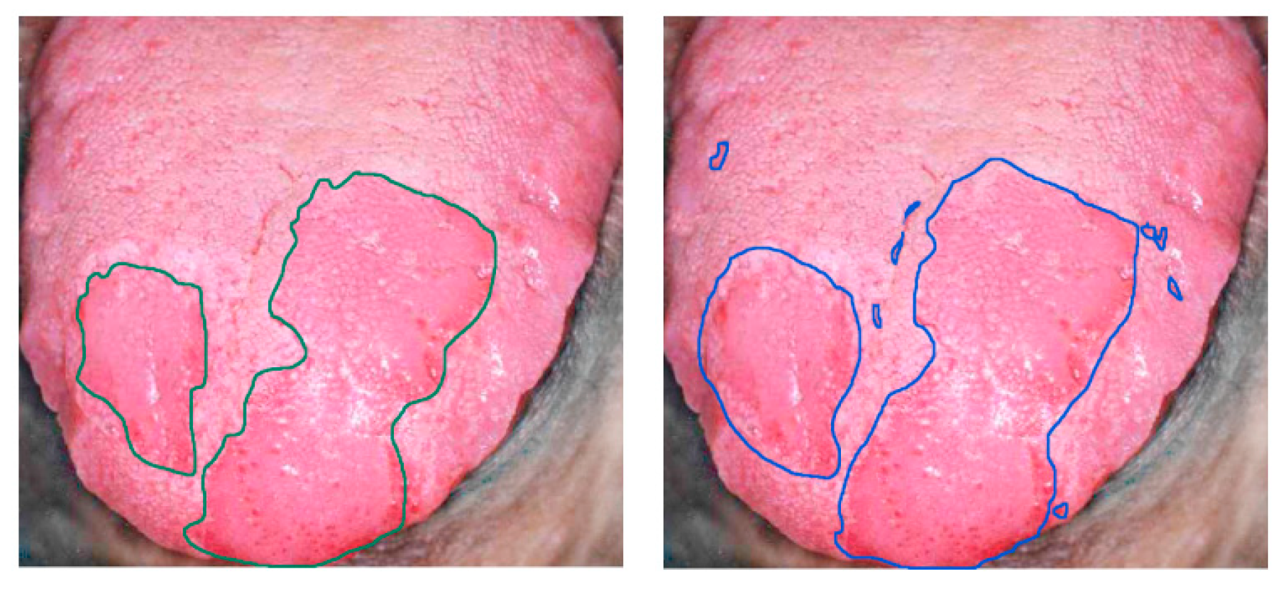 Cancers 11 00756 g010