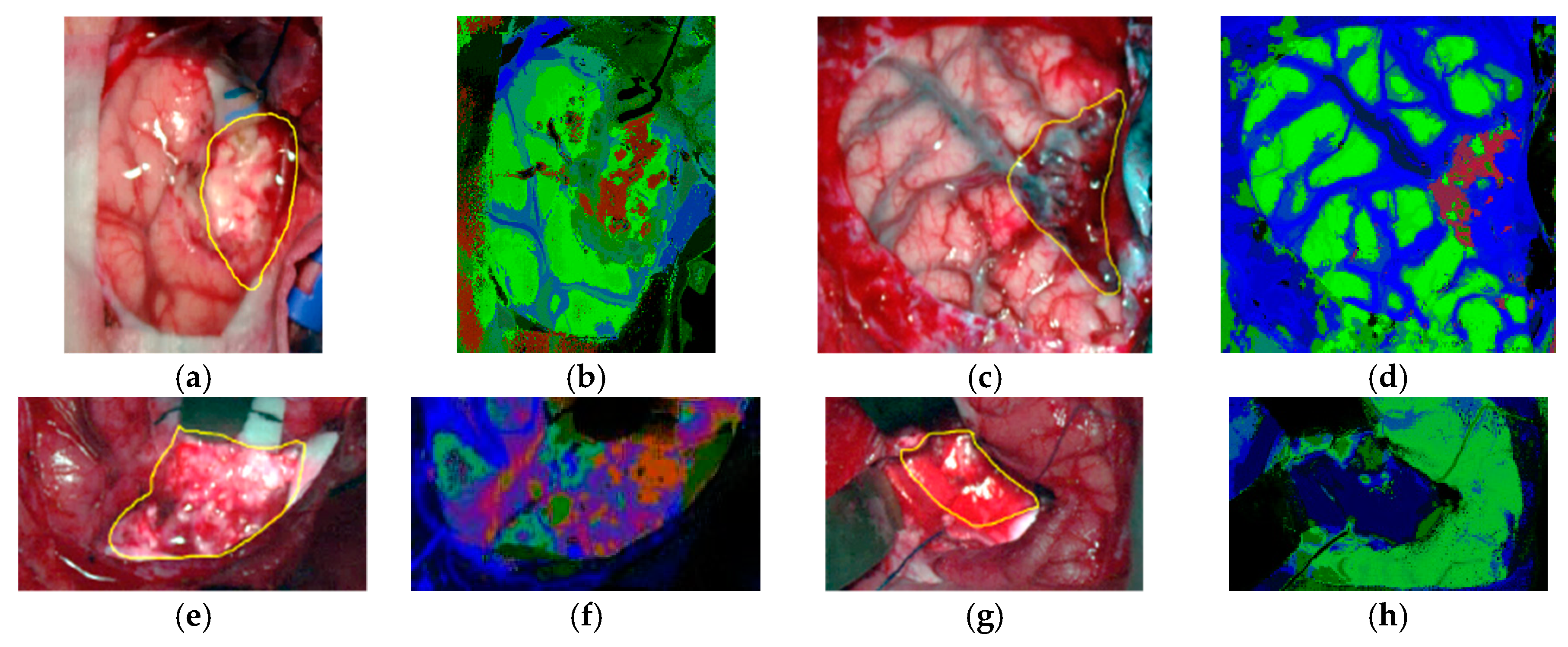 Cancers 11 00756 g012