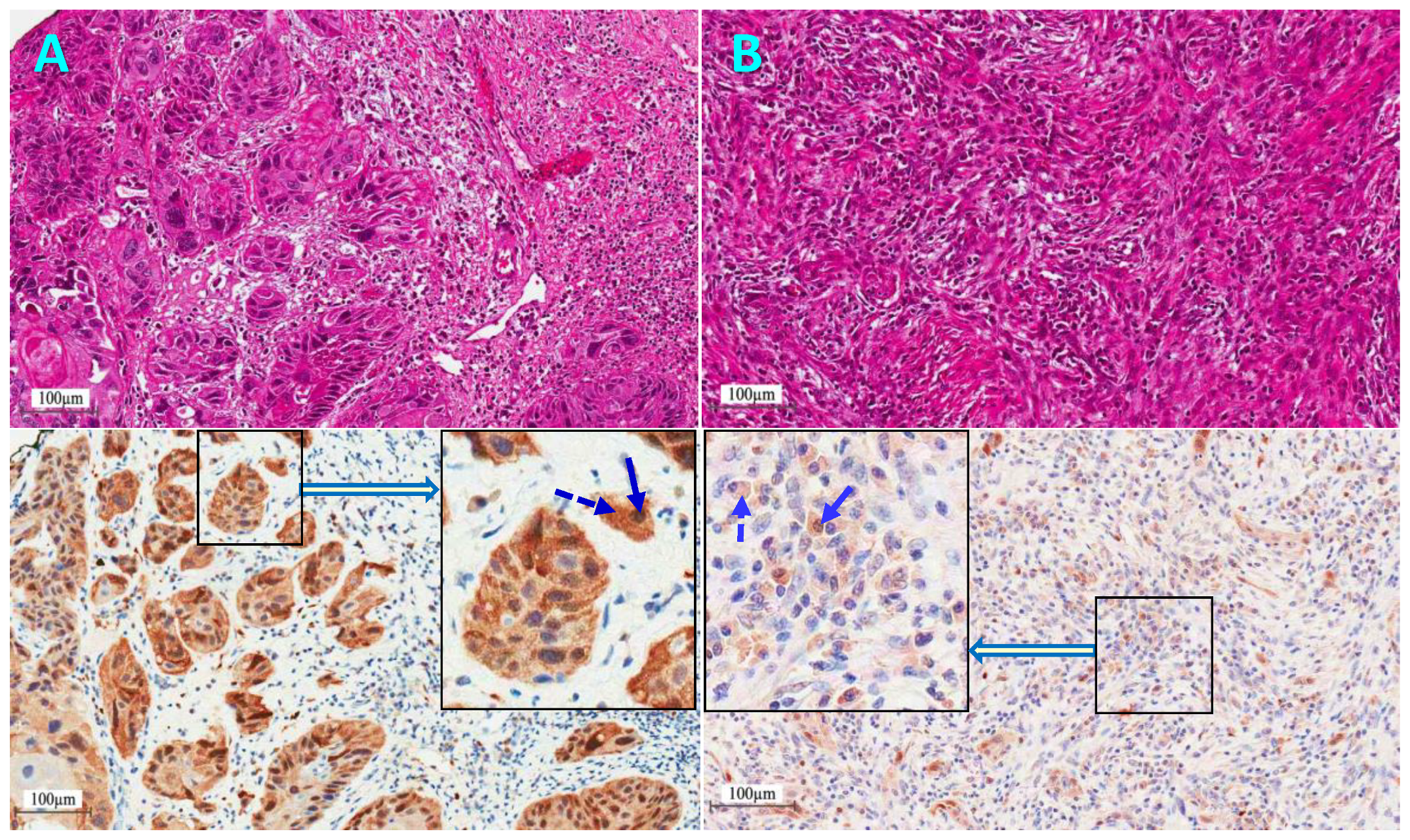 Cancers 11 00820 g005