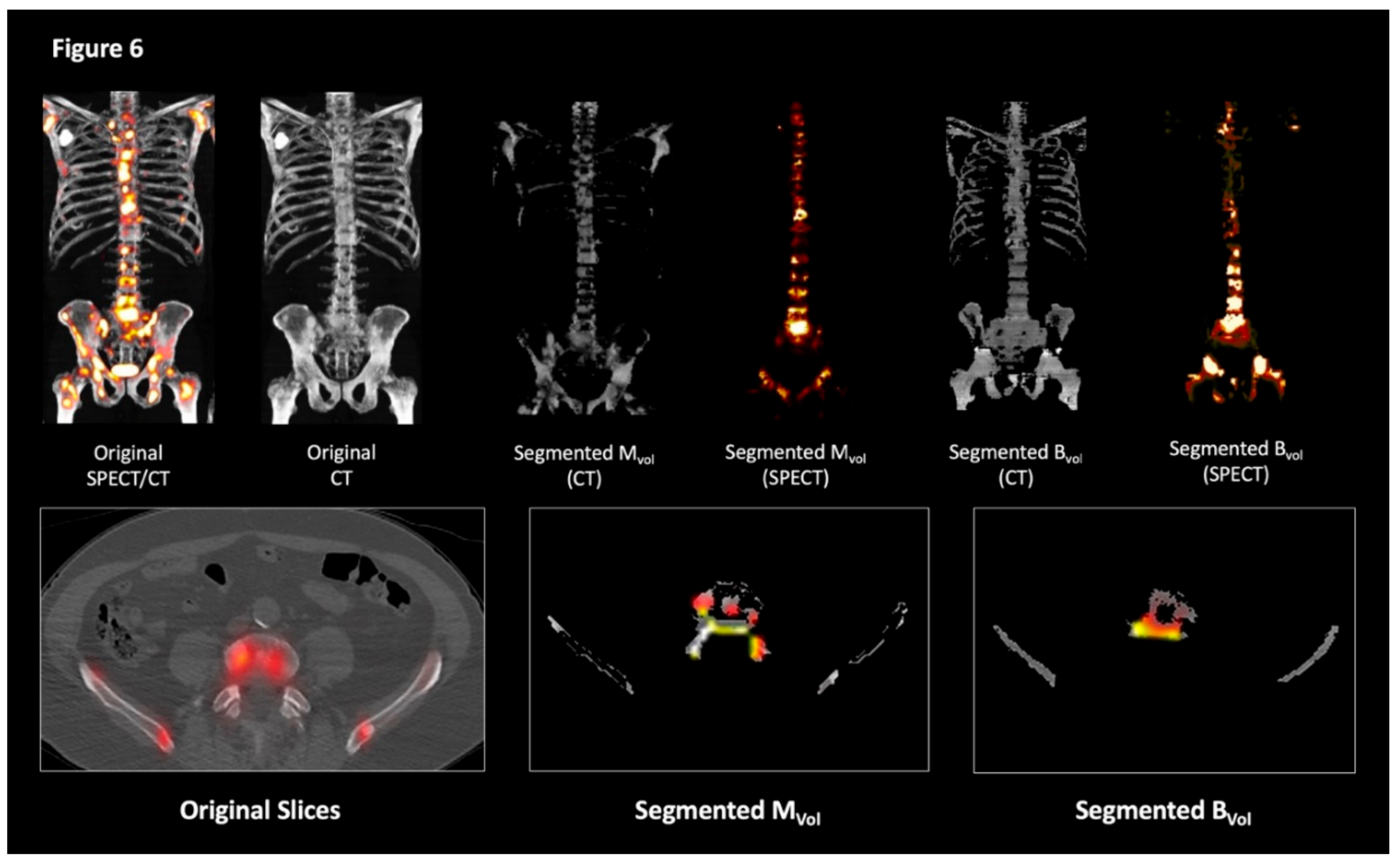 Cancers 11 00869 g006 Cancers 11 00869 g006