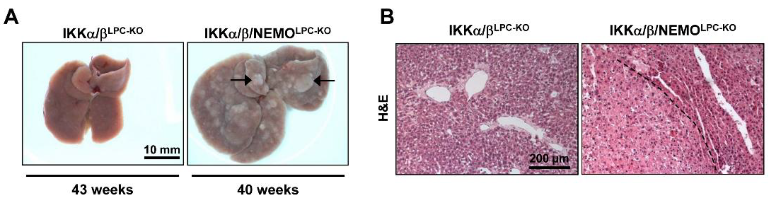 Cancers 11 00999 g006