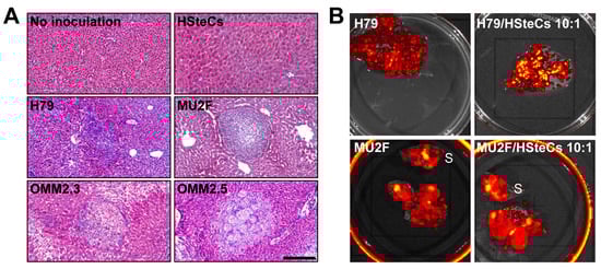 Cancers 11 01043 g0a1