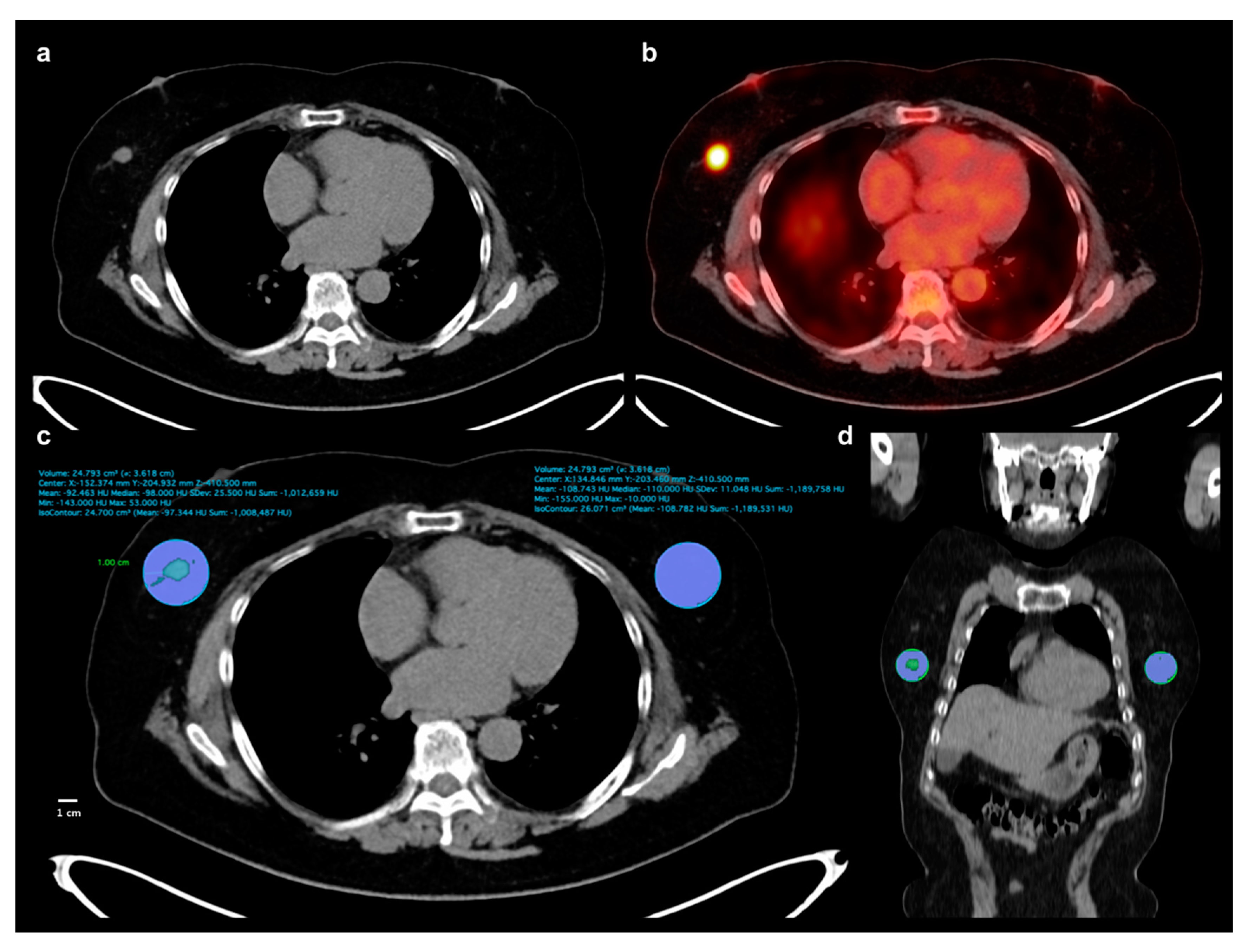 Cancers 11 01135 g004