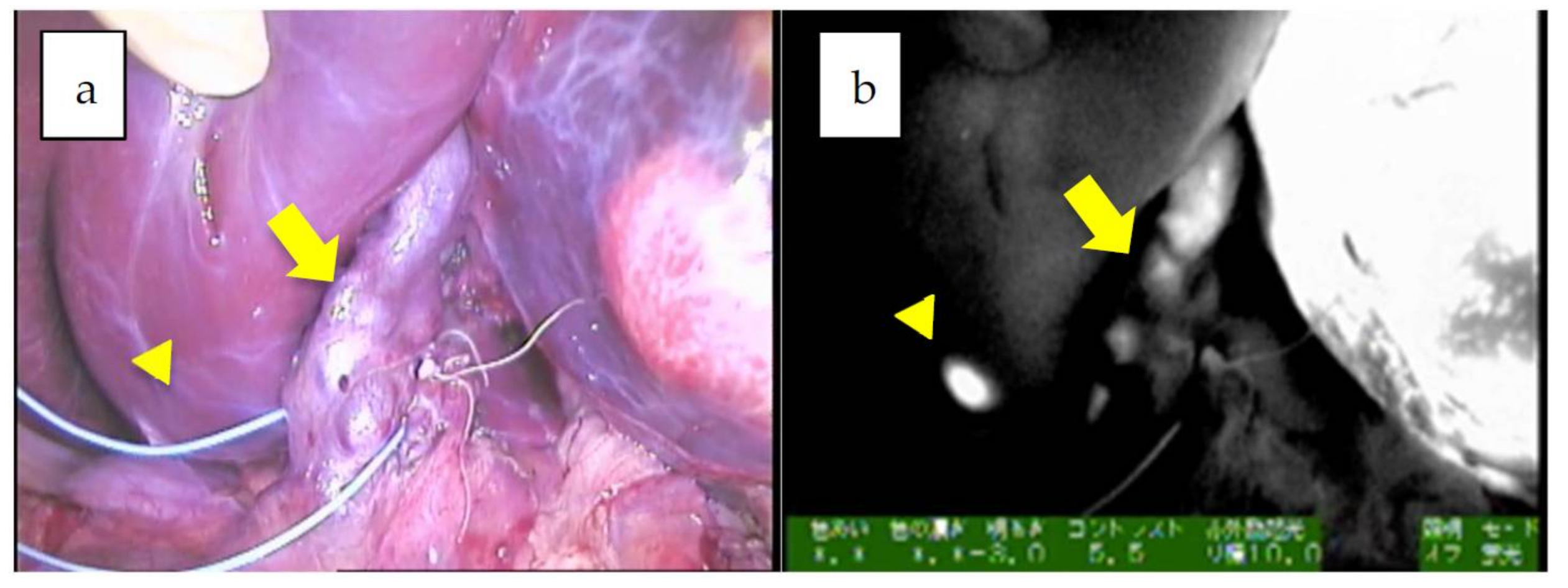Cancers 11 01215 g002 Cancers 11 01215 g002