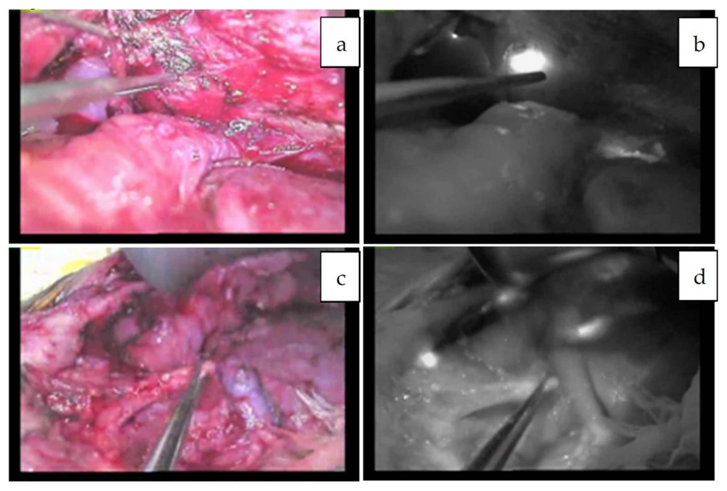 Cancers 11 01215 g006 Cancers 11 01215 g006