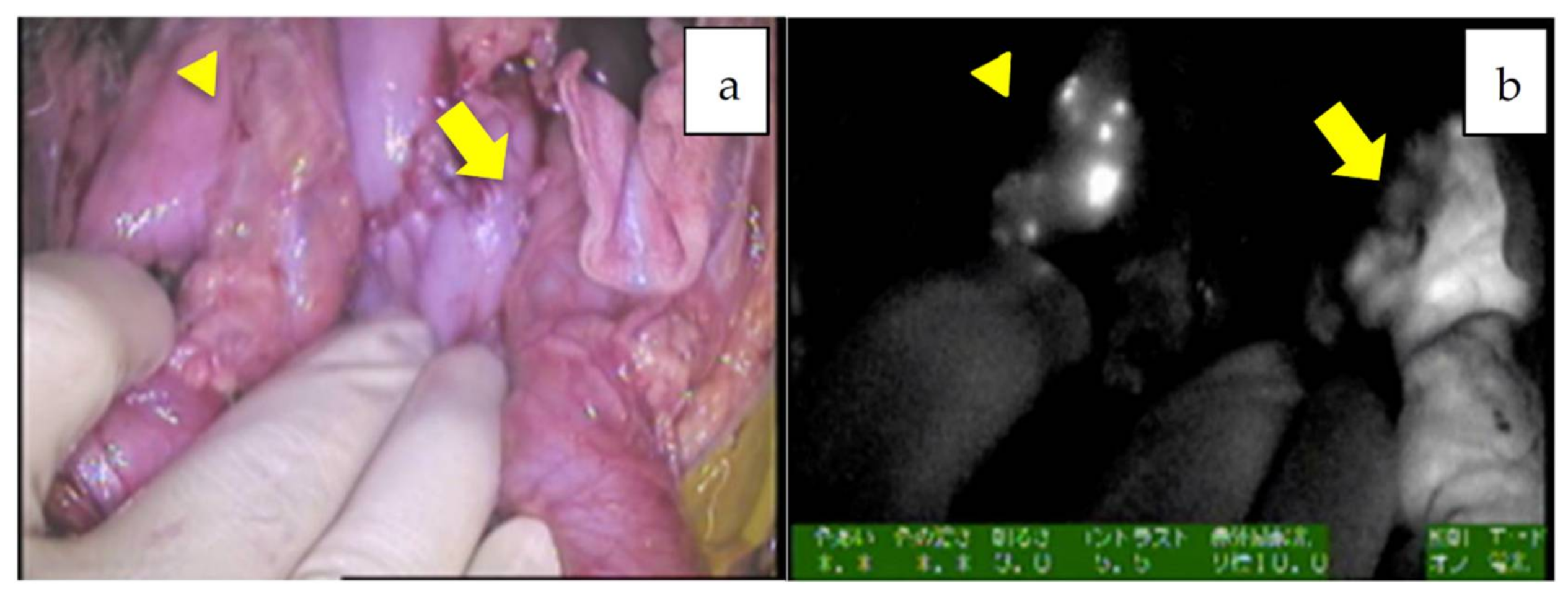 Cancers 11 01215 g009 Cancers 11 01215 g009