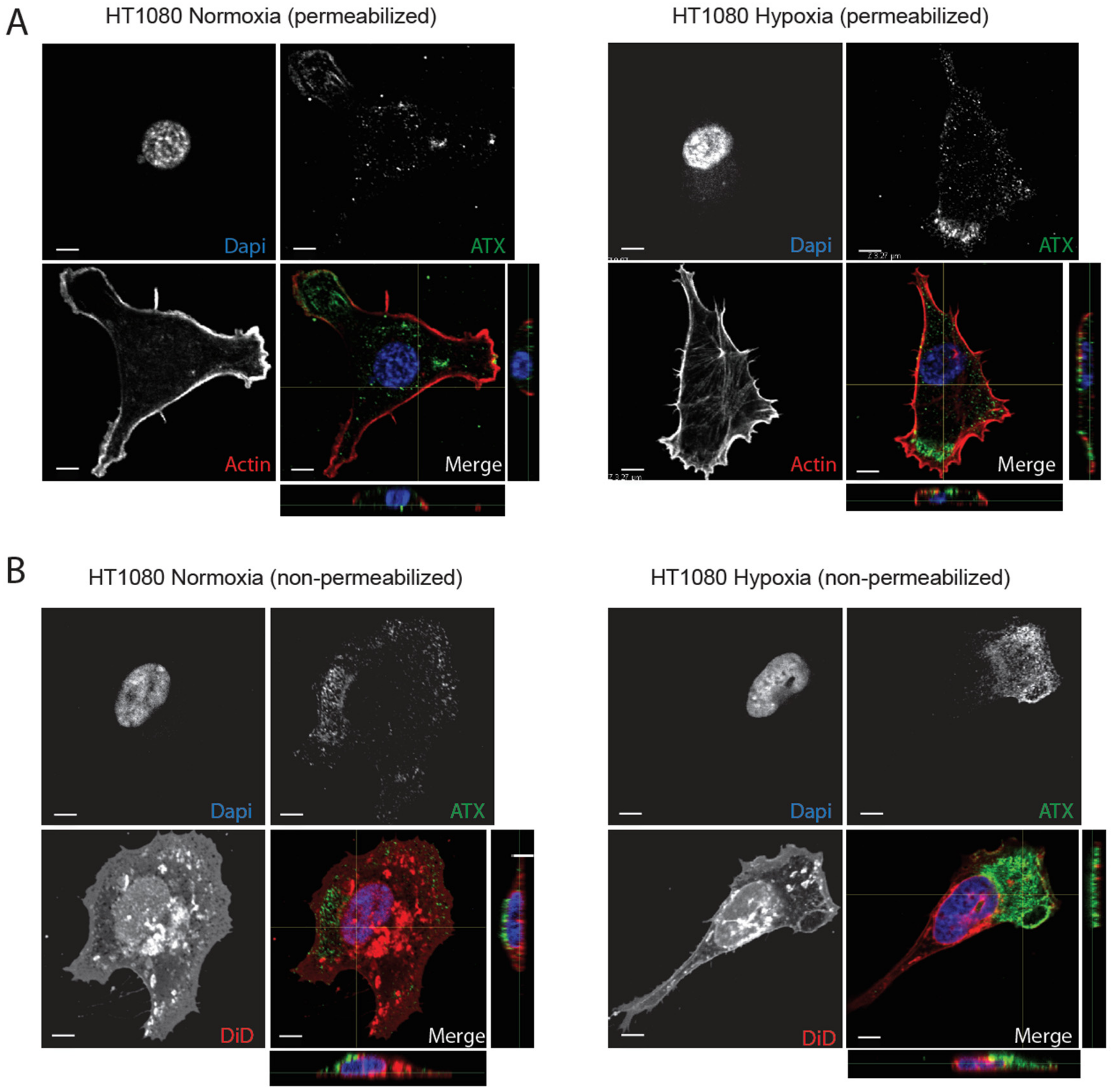 Cancers 11 01403 g004 Cancers 11 01403 g004