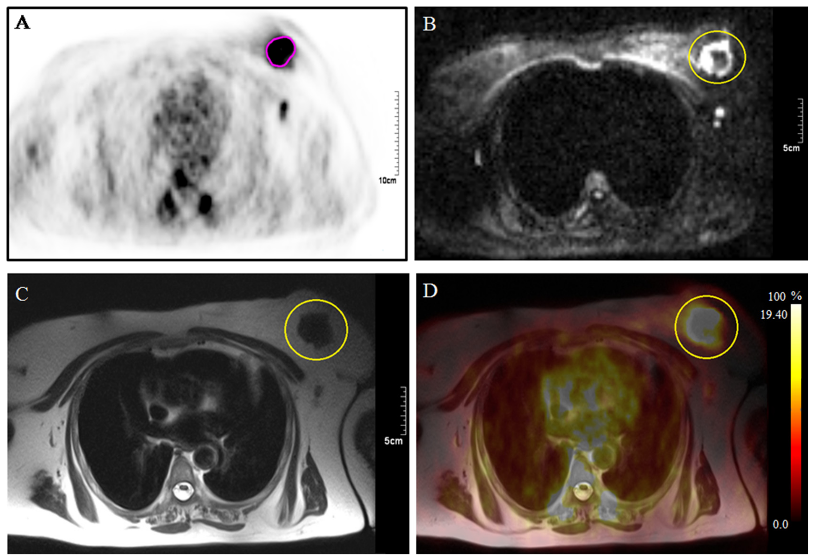 Cancers 11 01444 g002
