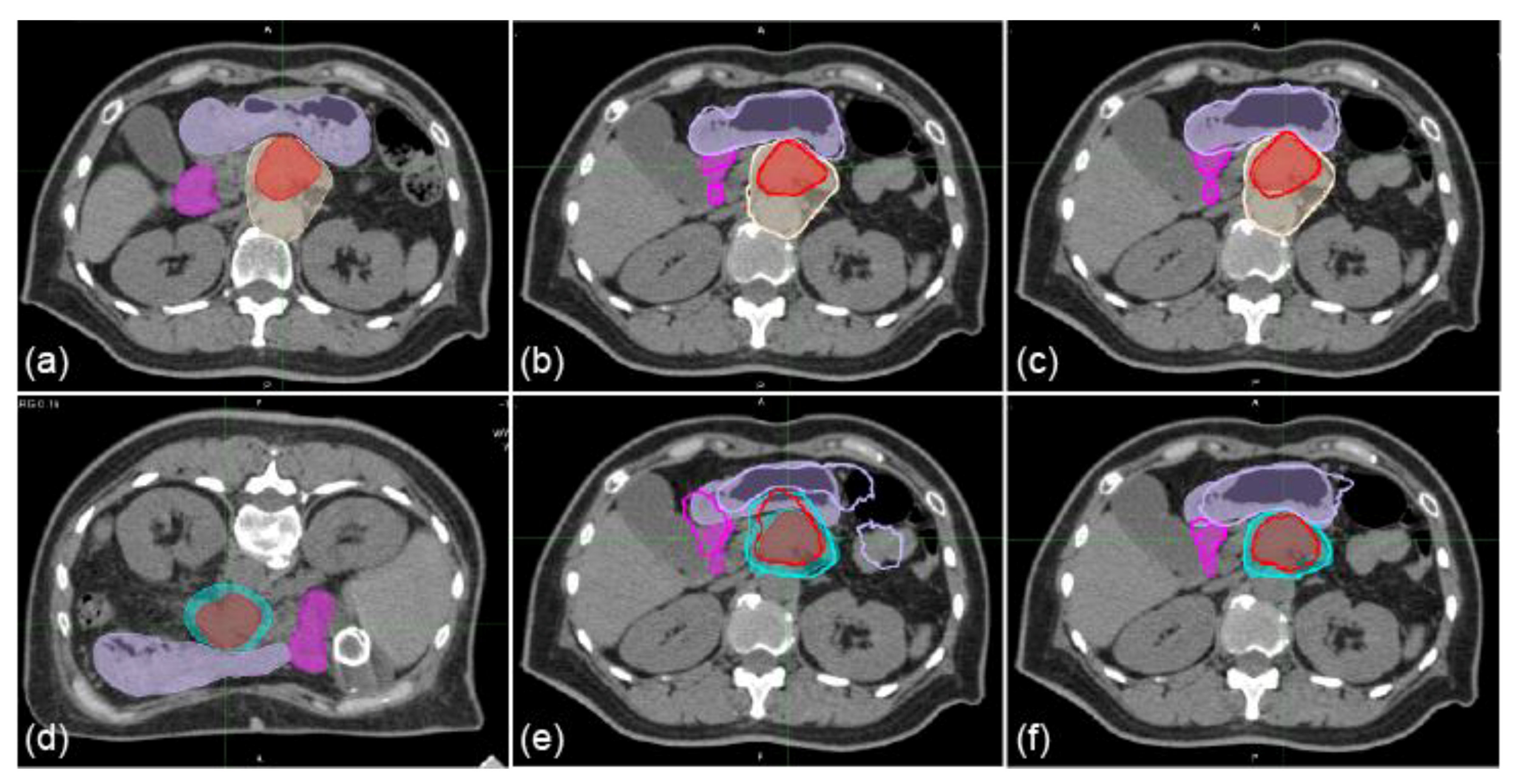 Cancers 11 01447 g001