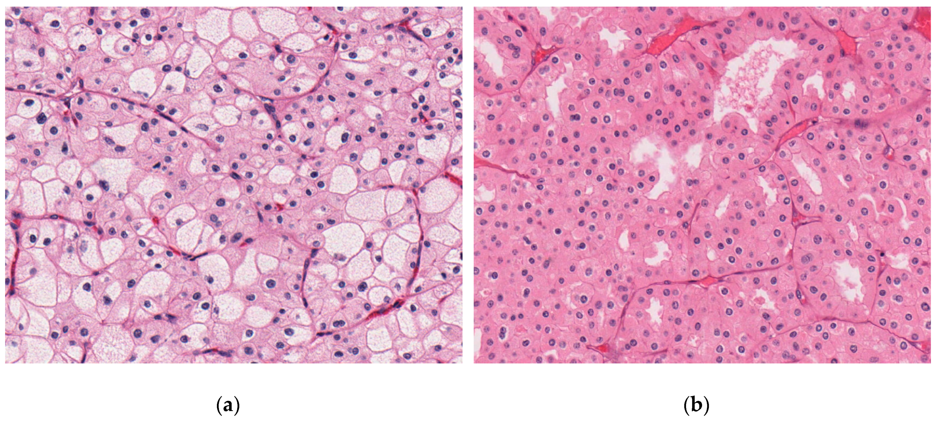 Cancers 11 01492 g003