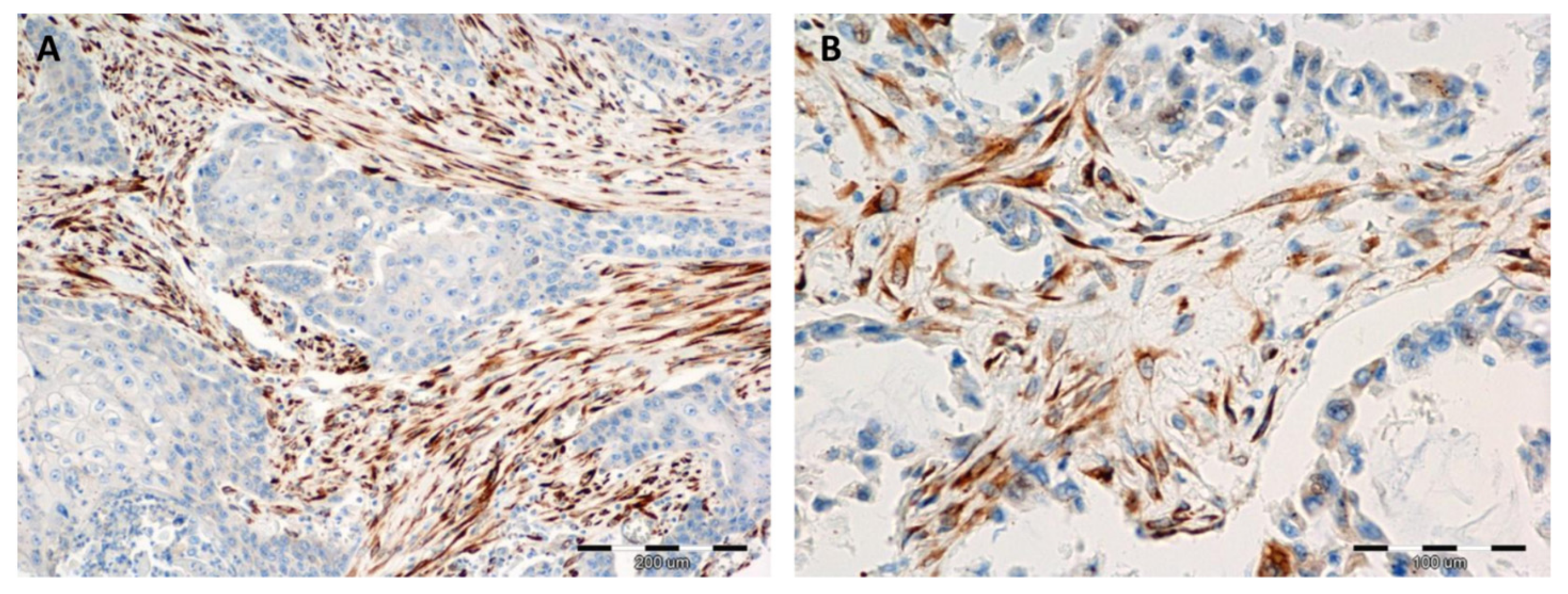 Cancers 11 01538 g002