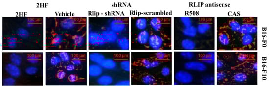Cancers 11 01556 g0a1