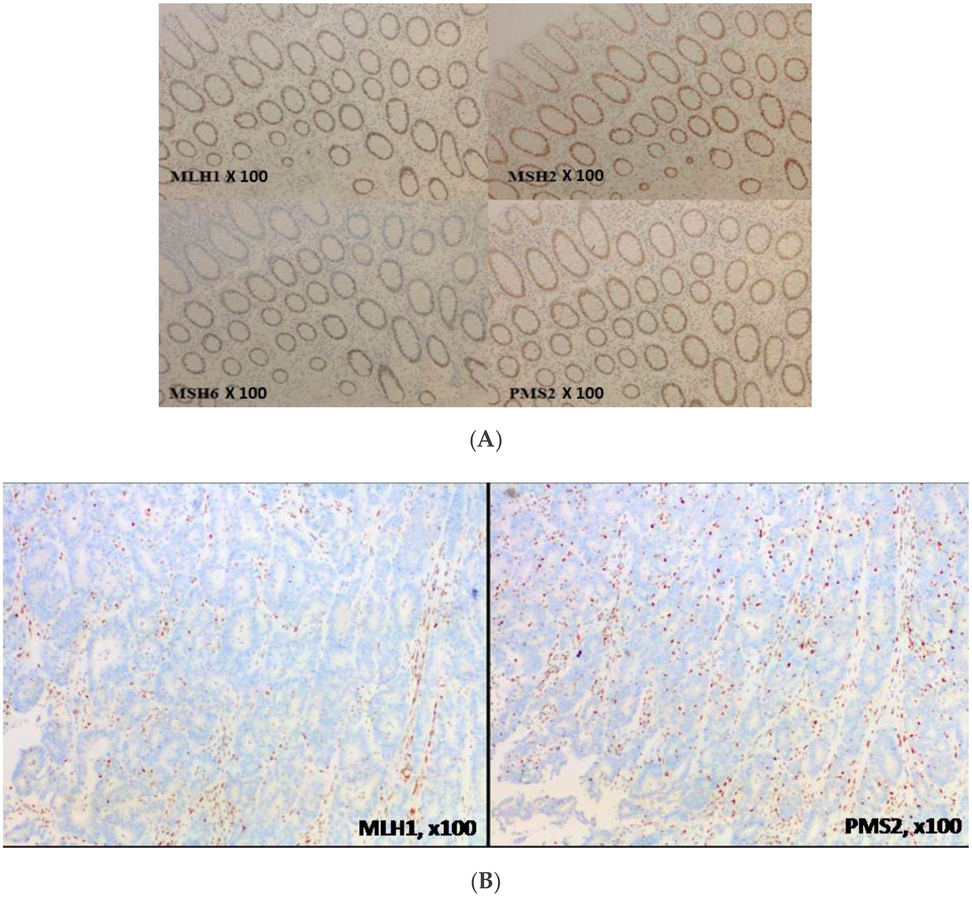 Cancers 11 01567 g004