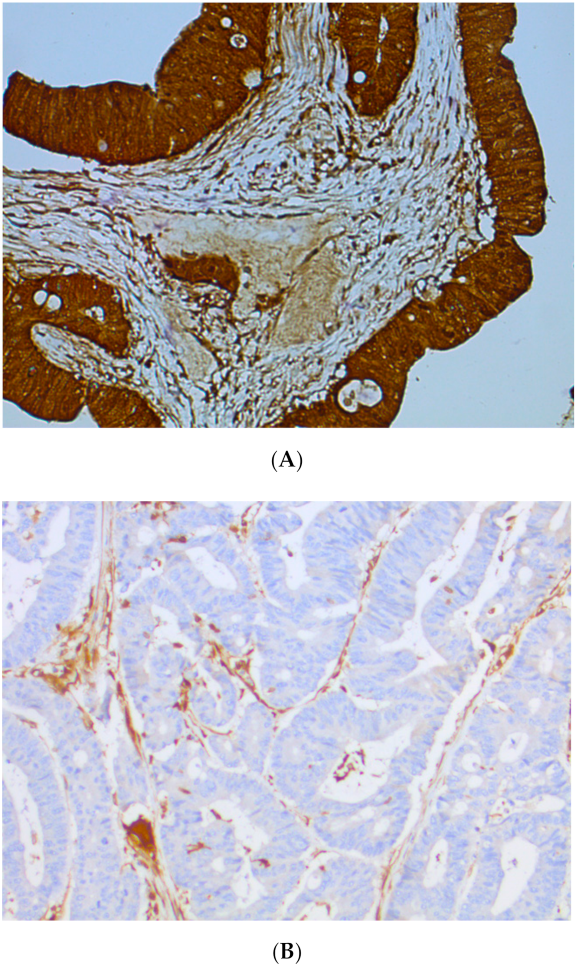 Cancers 11 01567 g007