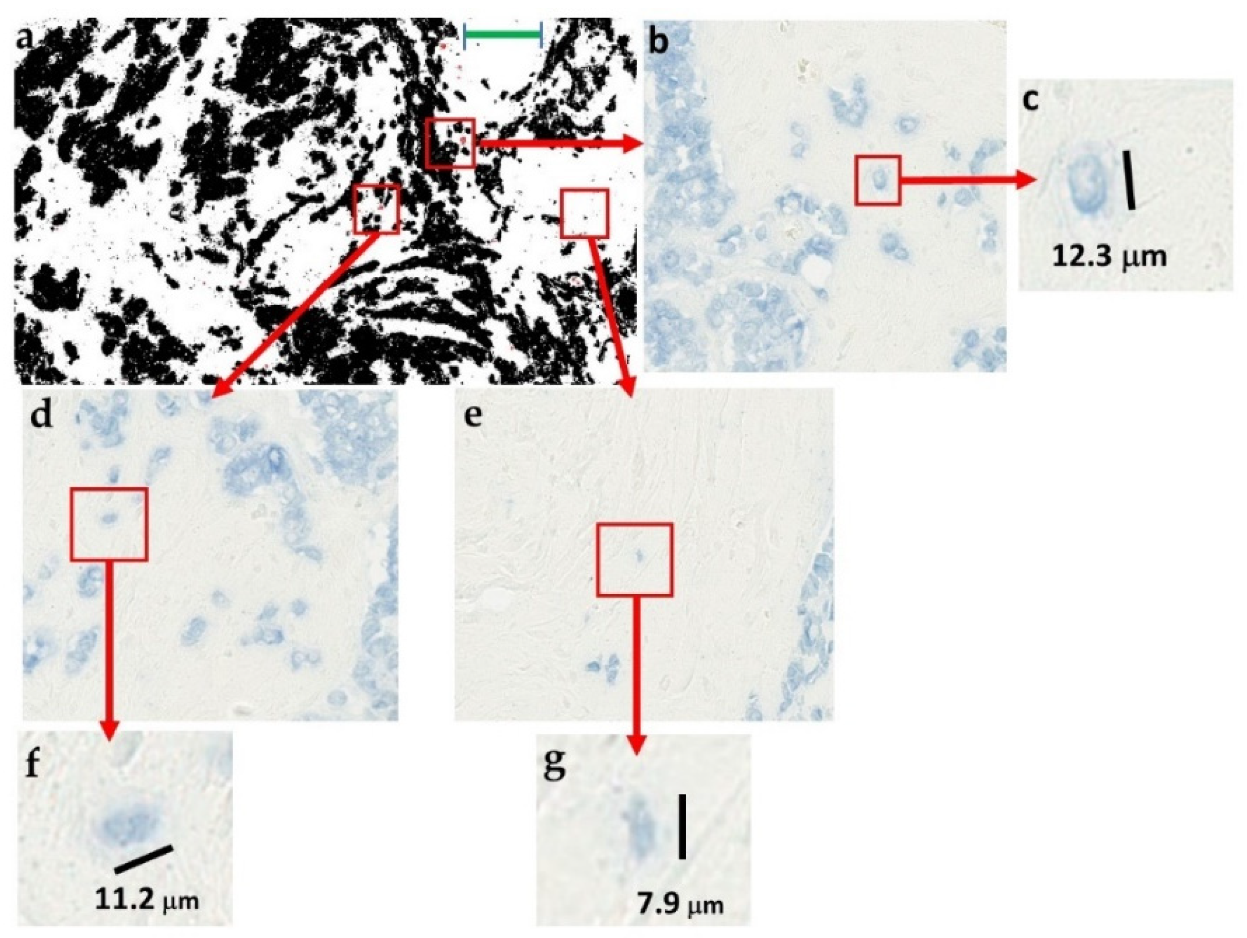 Cancers 11 01615 g004