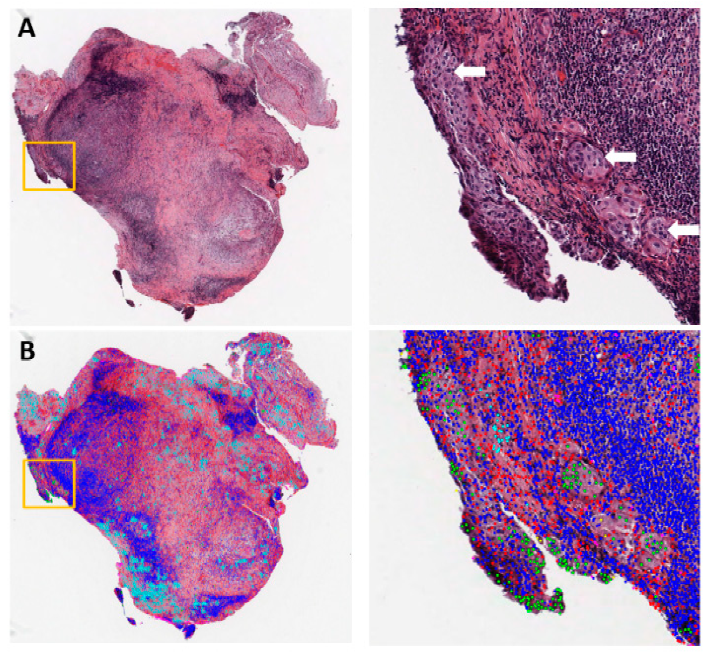 Cancers 11 01673 g001