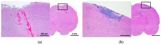 Cancers 11 01850 g003a Cancers 11 01850 g003a