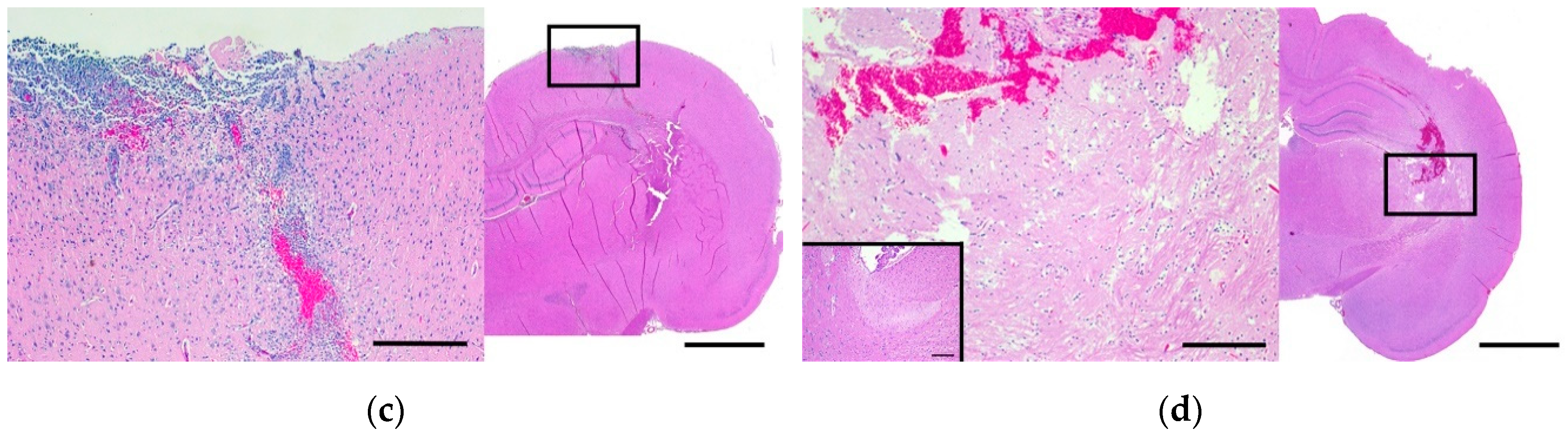 Cancers 11 01850 g003b Cancers 11 01850 g003b