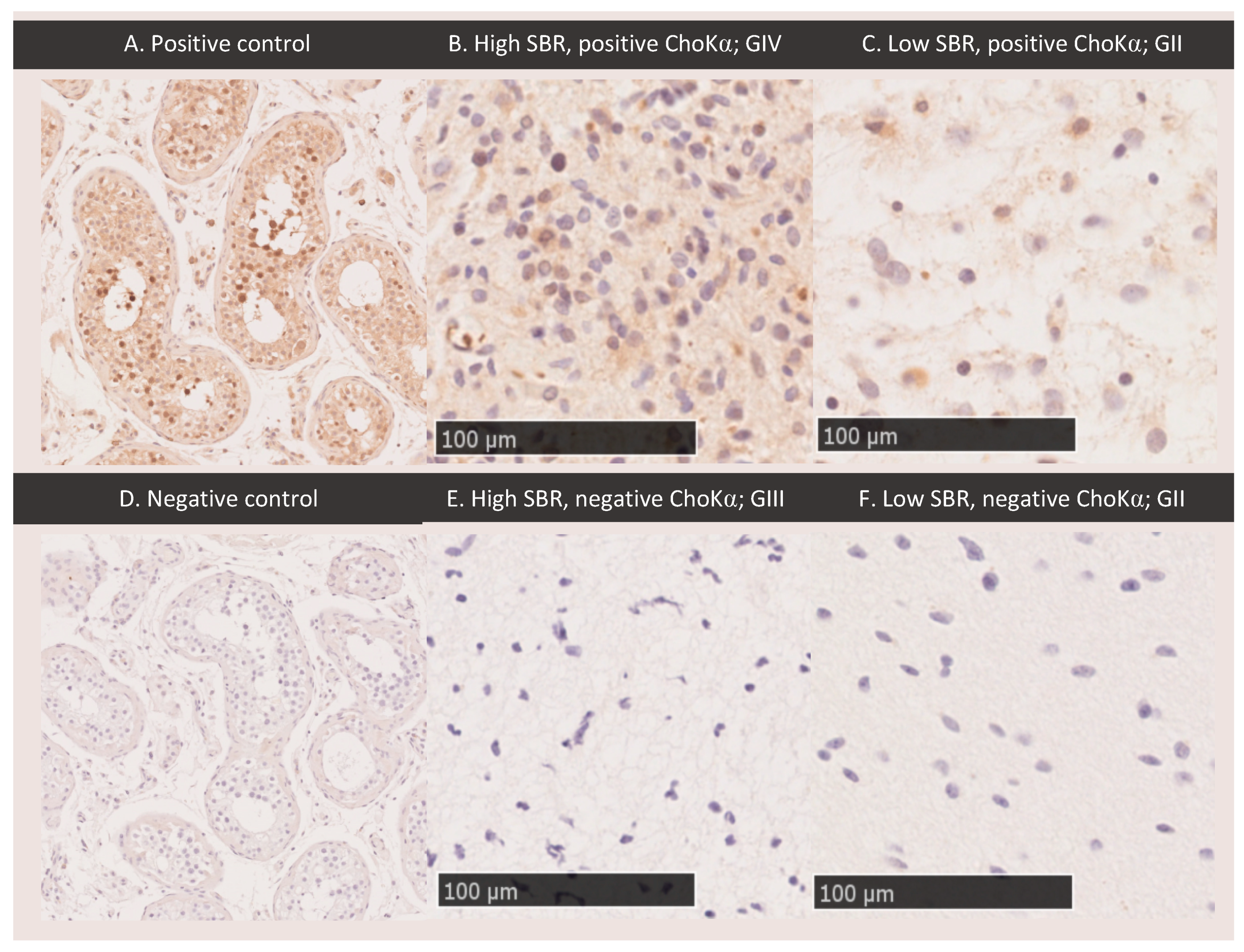 Cancers 11 01969 g004 Cancers 11 01969 g004