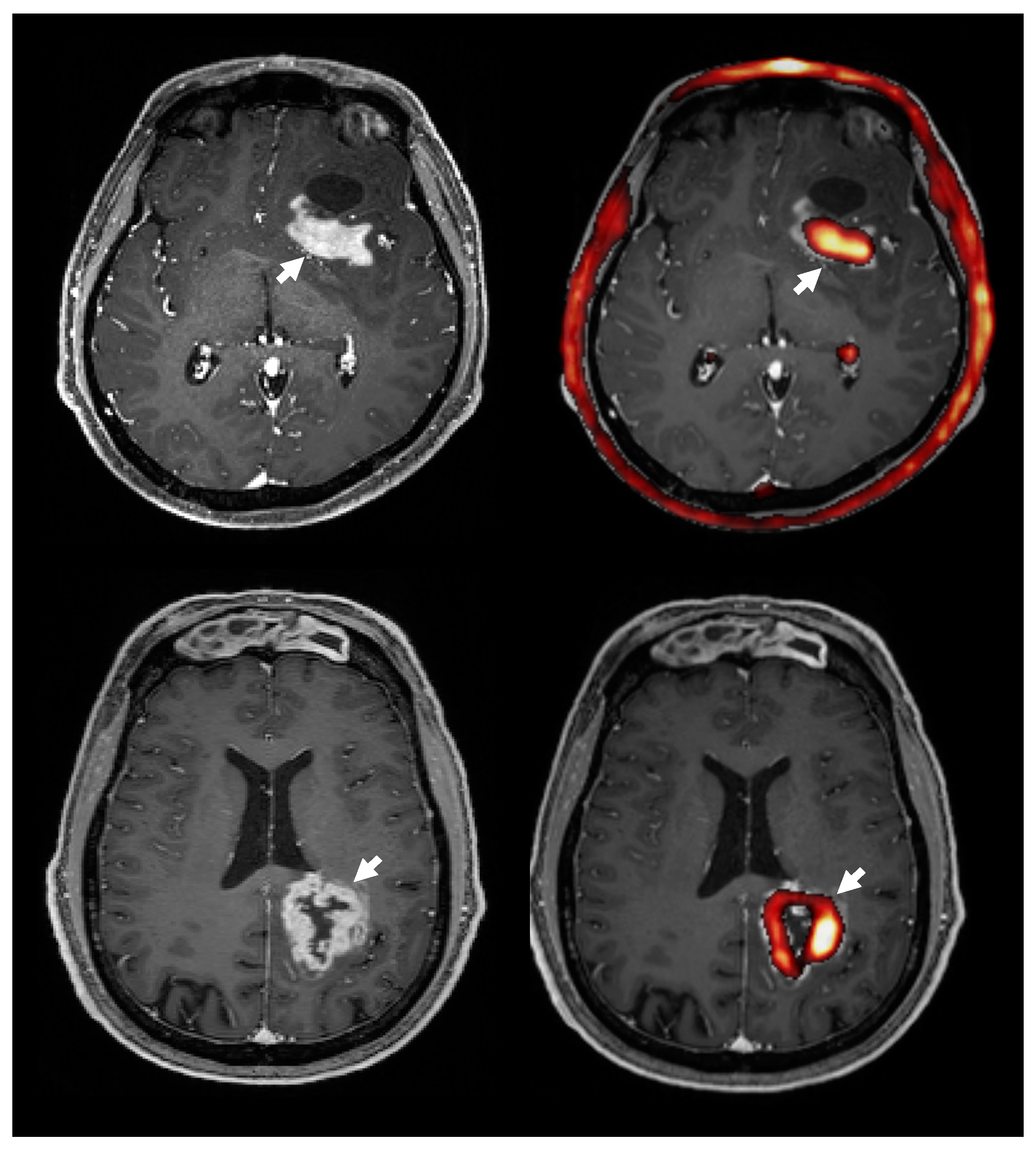 Cancers 11 01969 g005 Cancers 11 01969 g005
