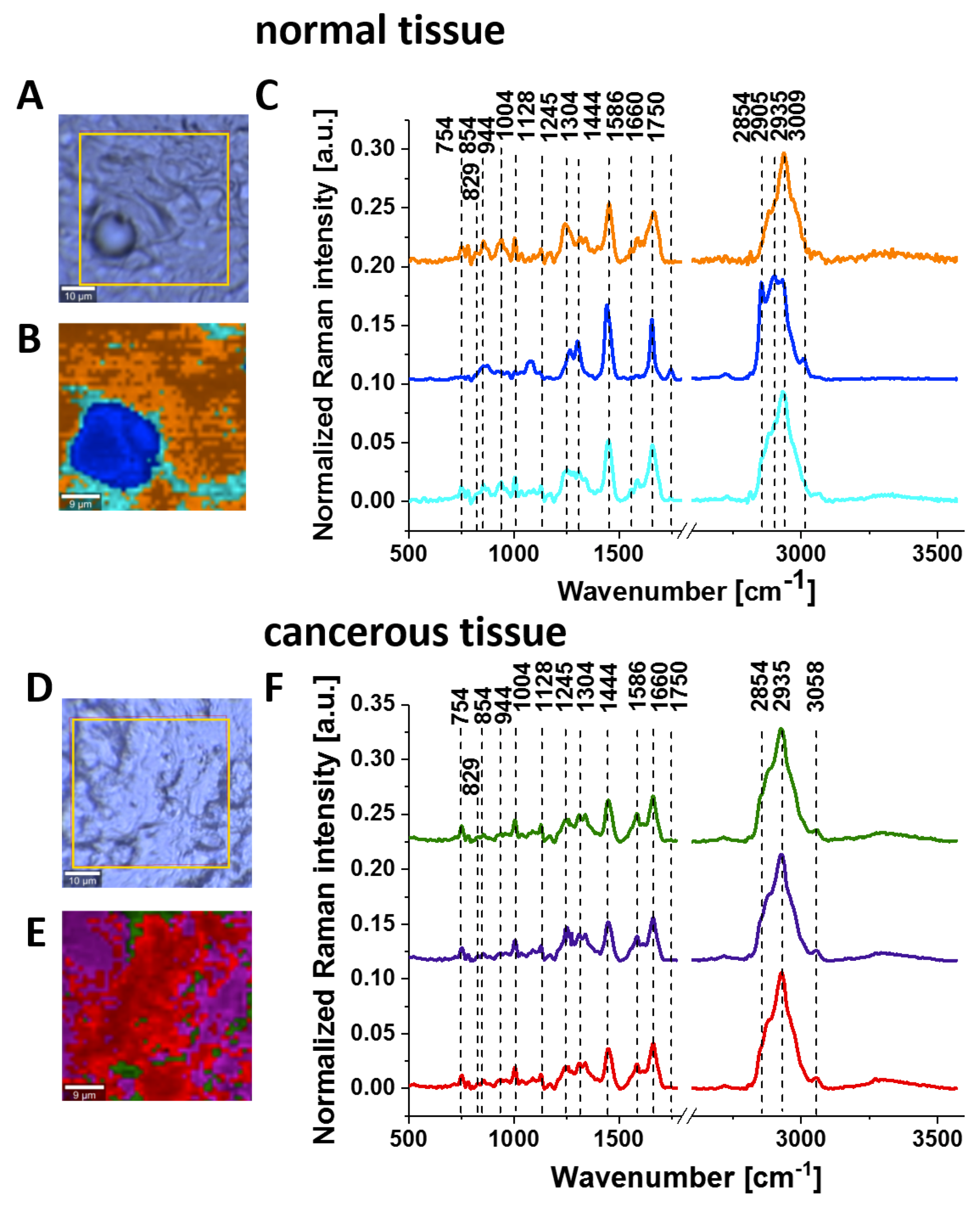 Cancers 11 02017 g005 Cancers 11 02017 g005