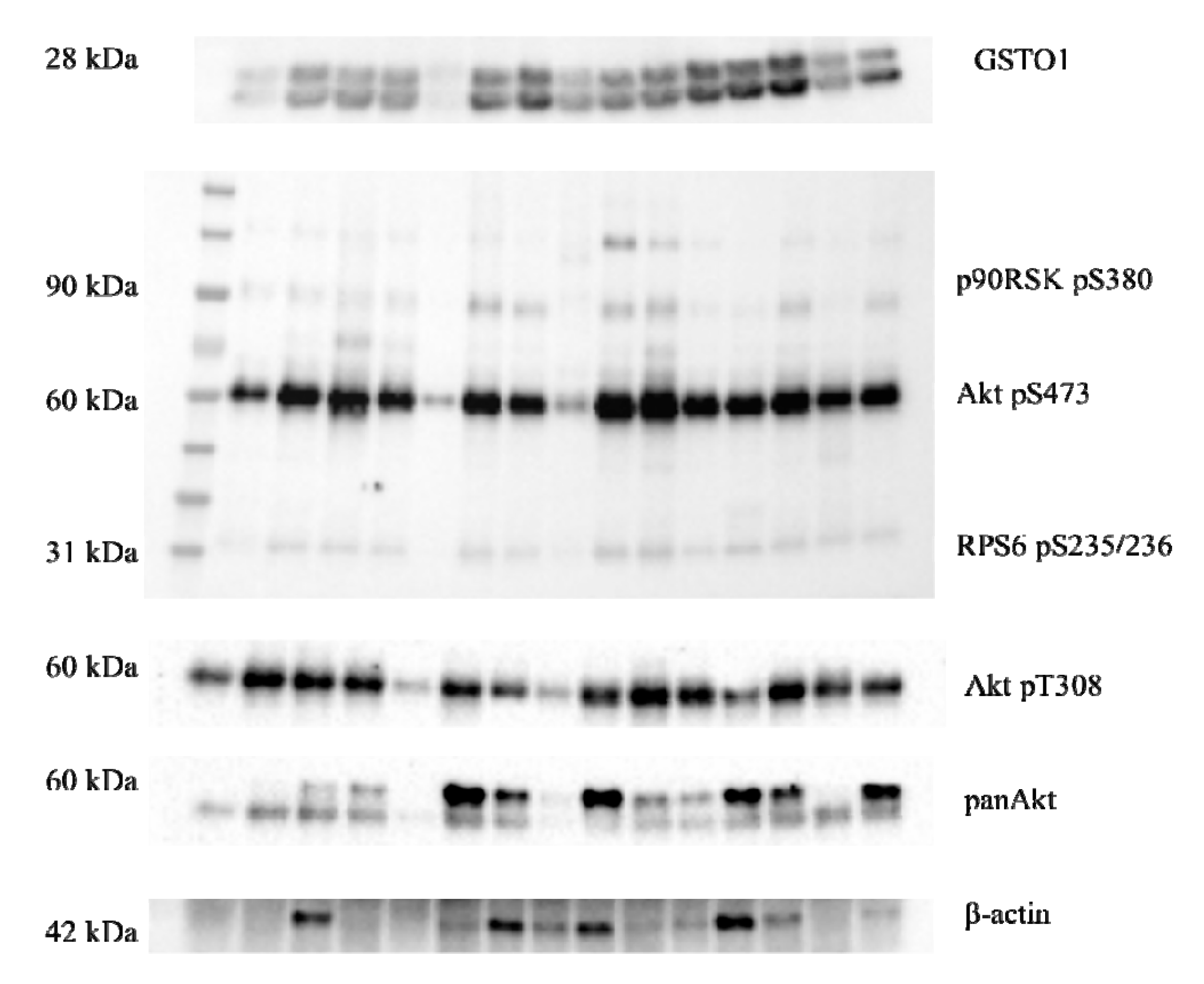 Cancers 11 02038 g004