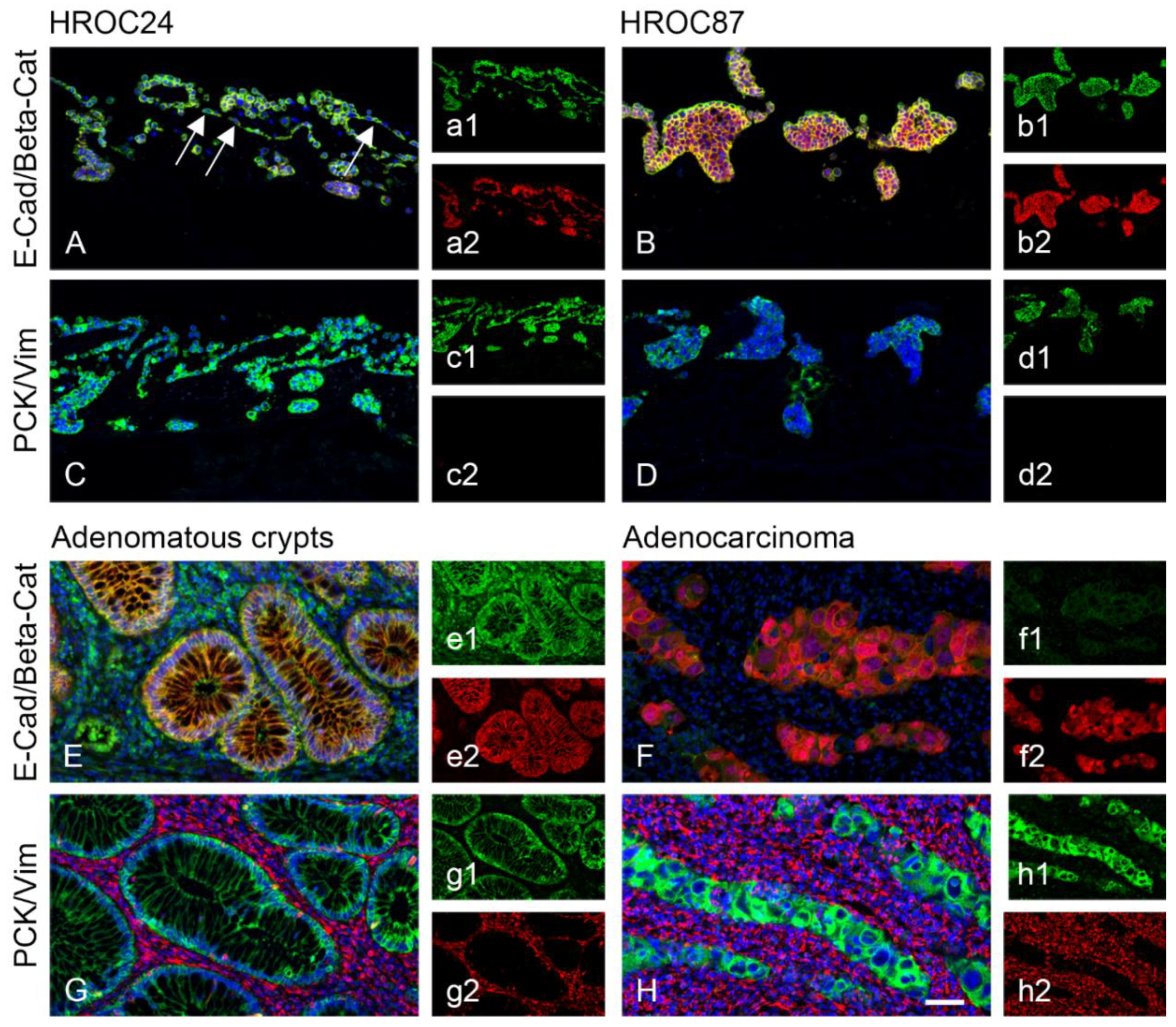 Cancers 12 00028 g002
